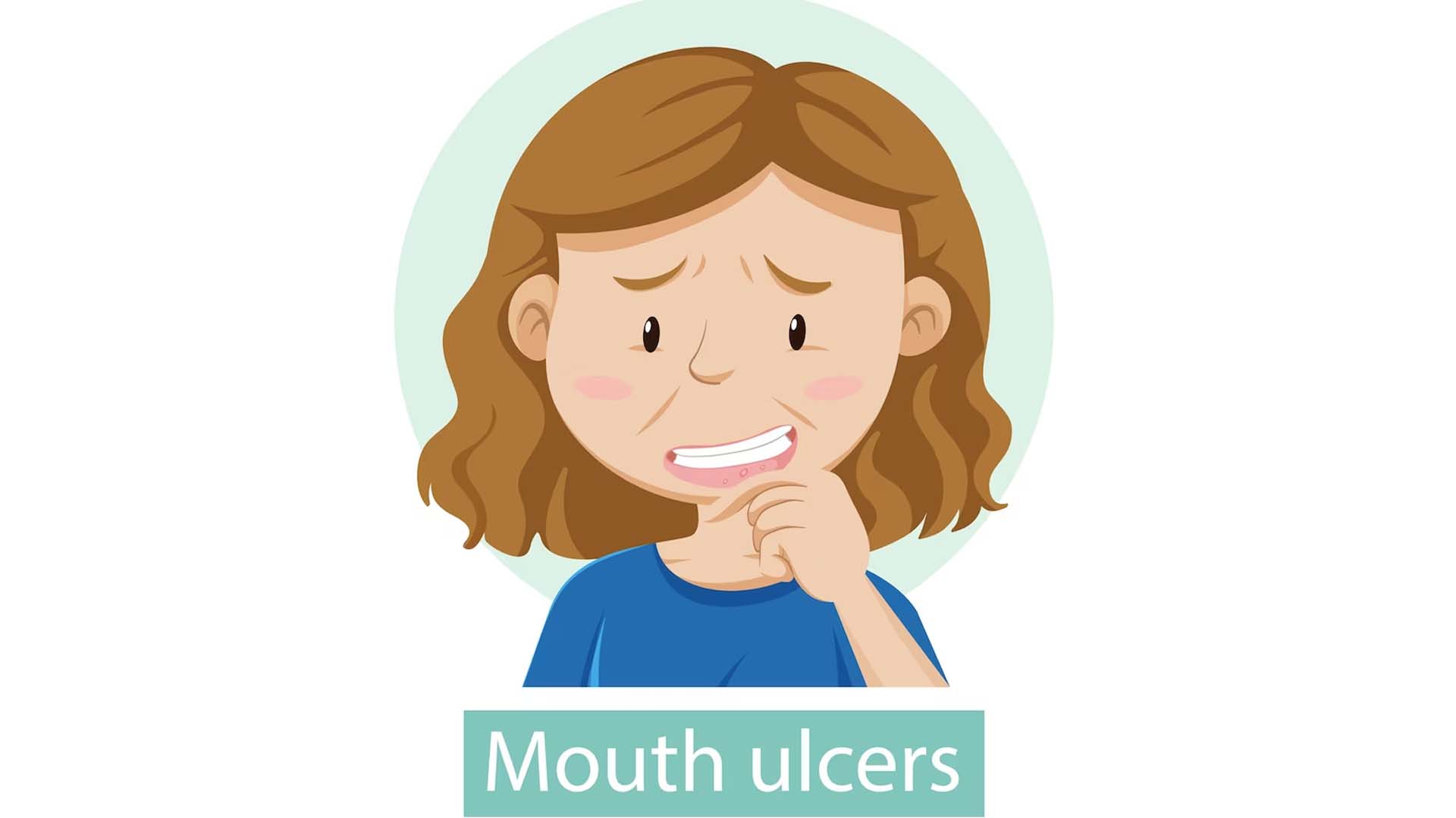 Mouth ulcers
