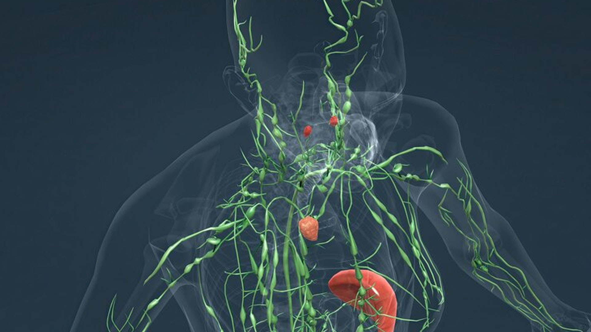 What are the Symptoms of Non Hodgkin's Lymphoma?