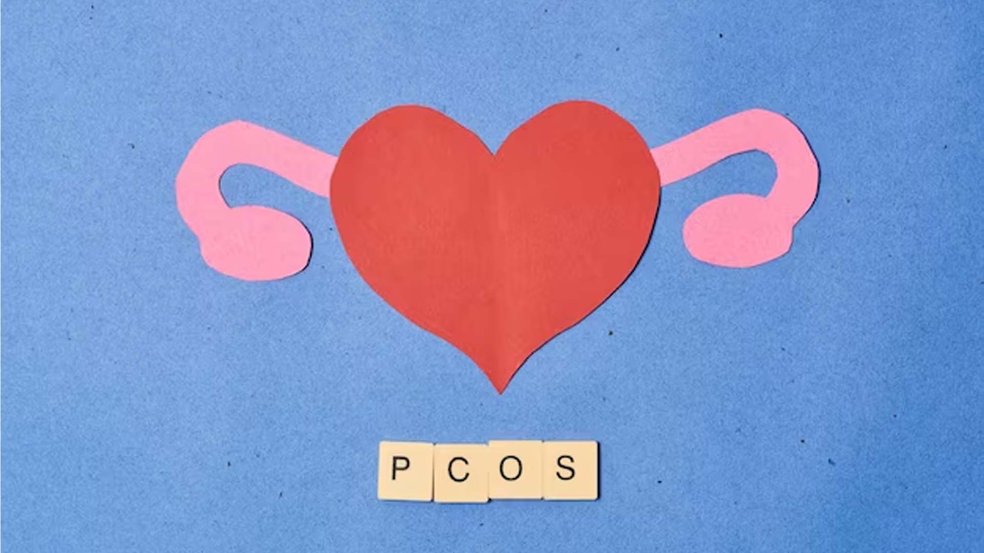 Polycystic Ovary Syndrome (PCOS)