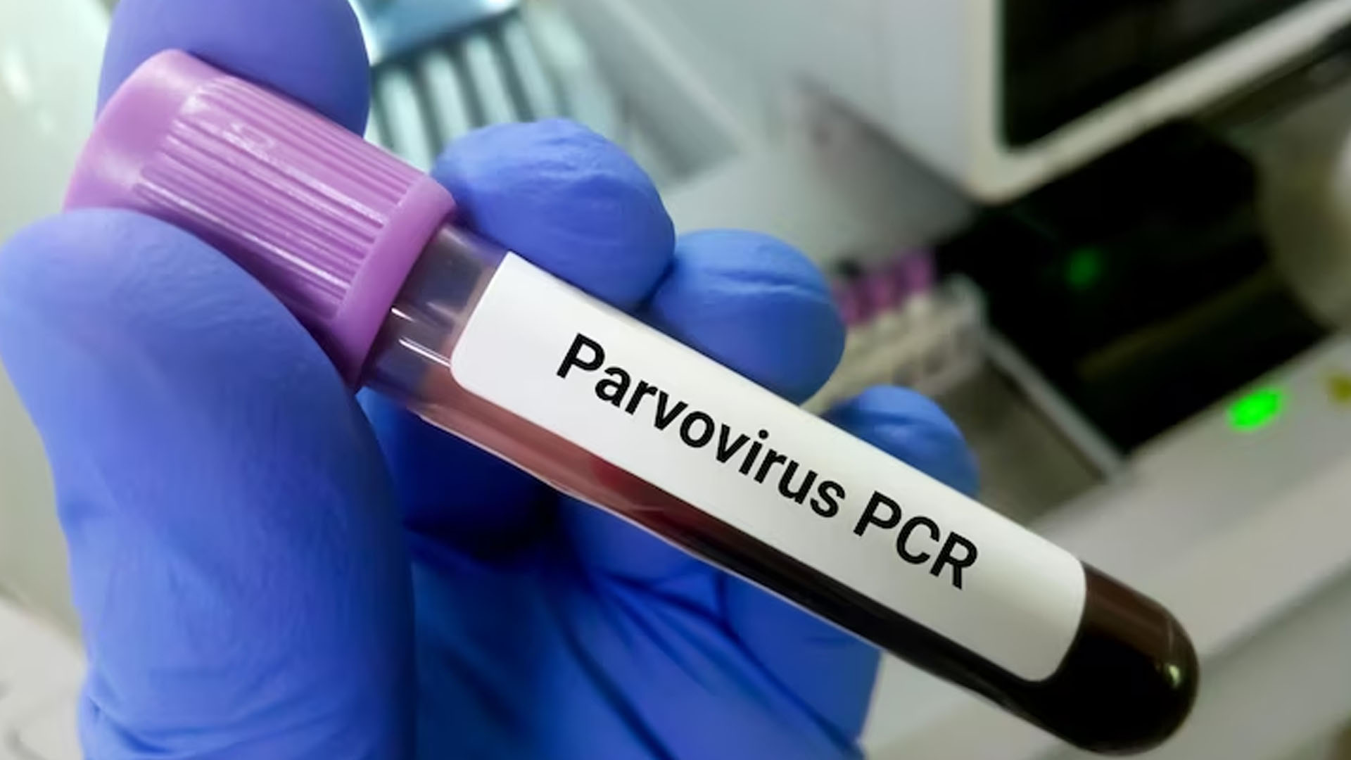 How Long do Parvo Symptoms Last?