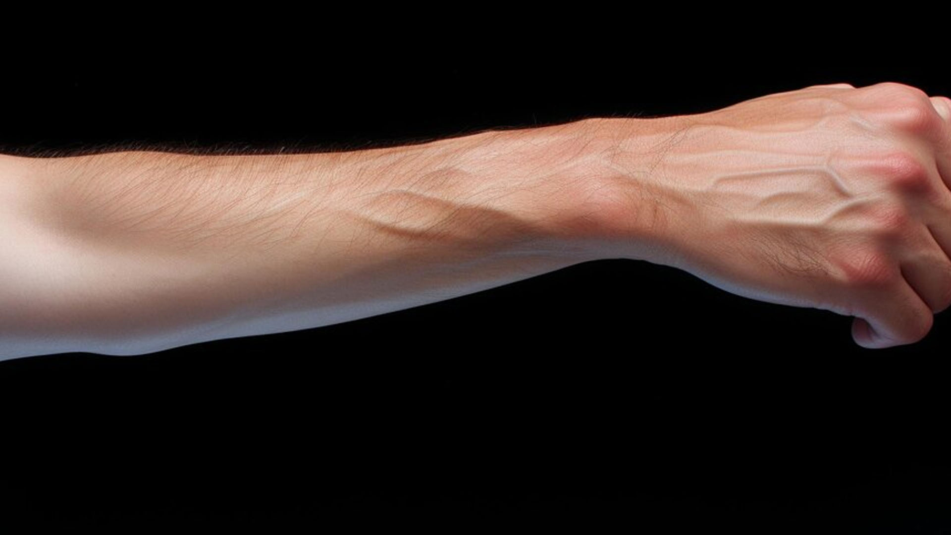 What are the Symptoms of Phlebitis?