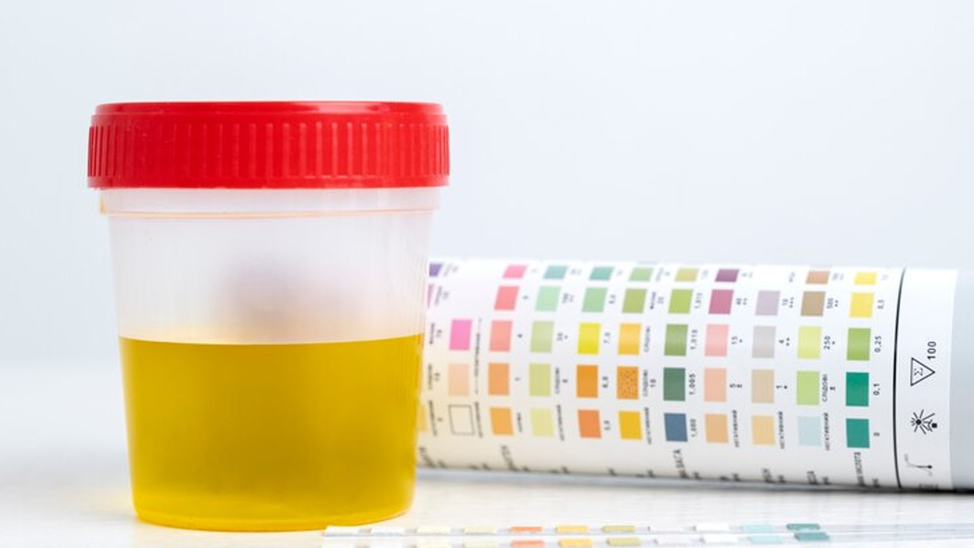 What are the Symptoms of Pus Cells in Urine?