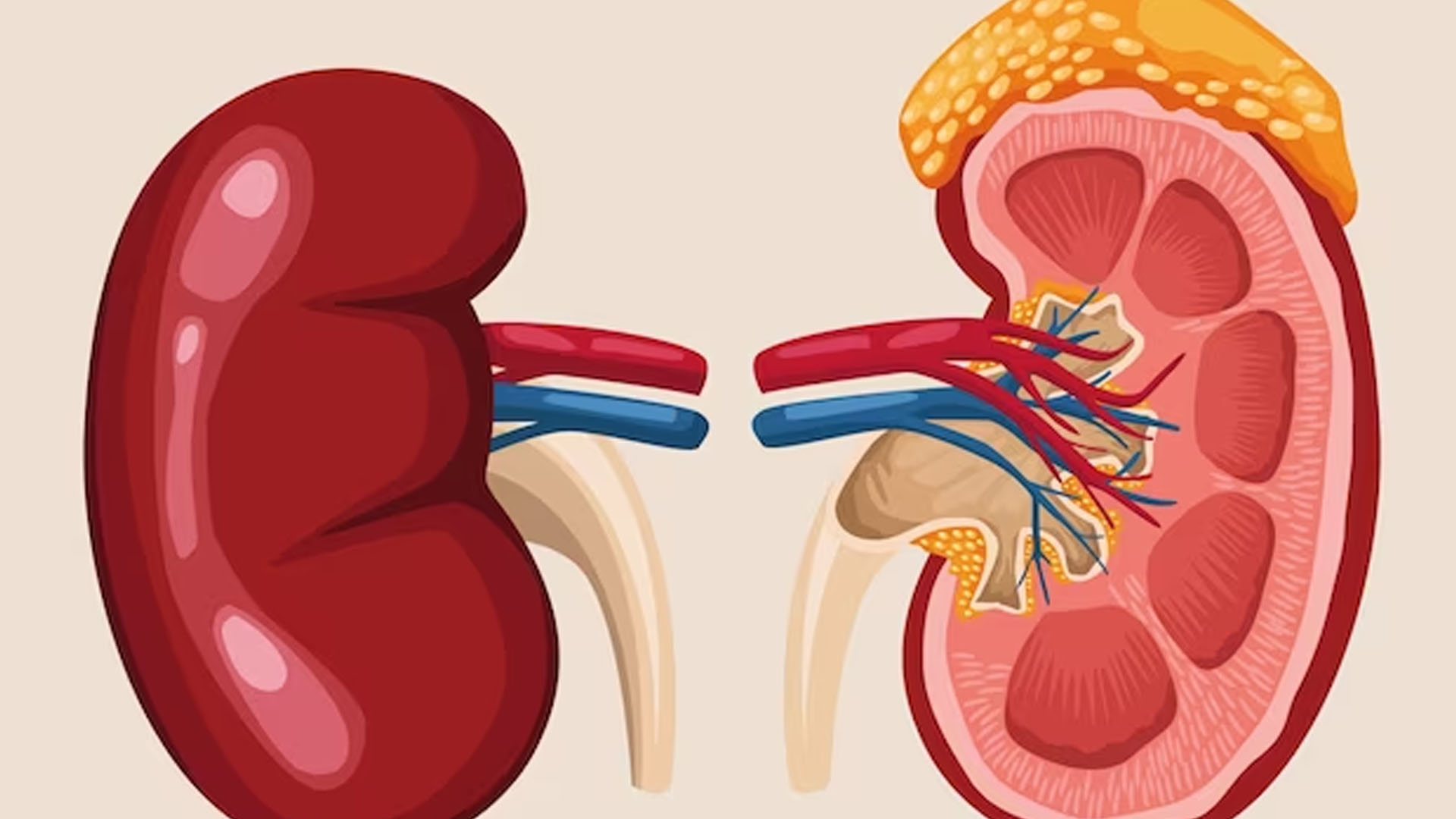 What are the Symptoms of Renal Colic?