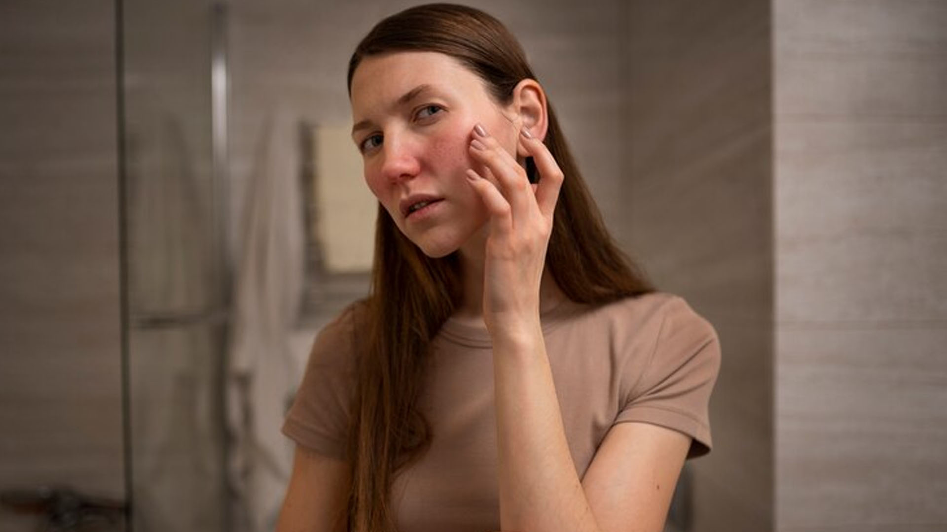 How to Relieve Rosacea Symptoms?