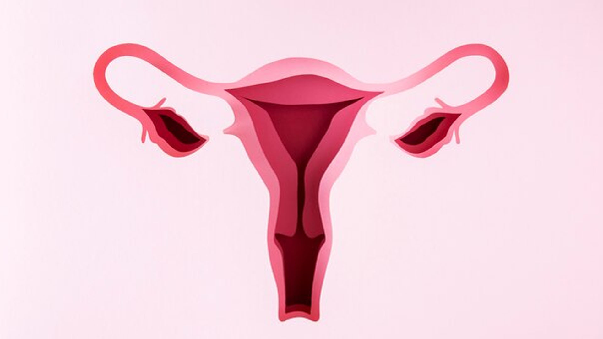 What are the Symptoms of a Ruptured Ovarian Cyst?