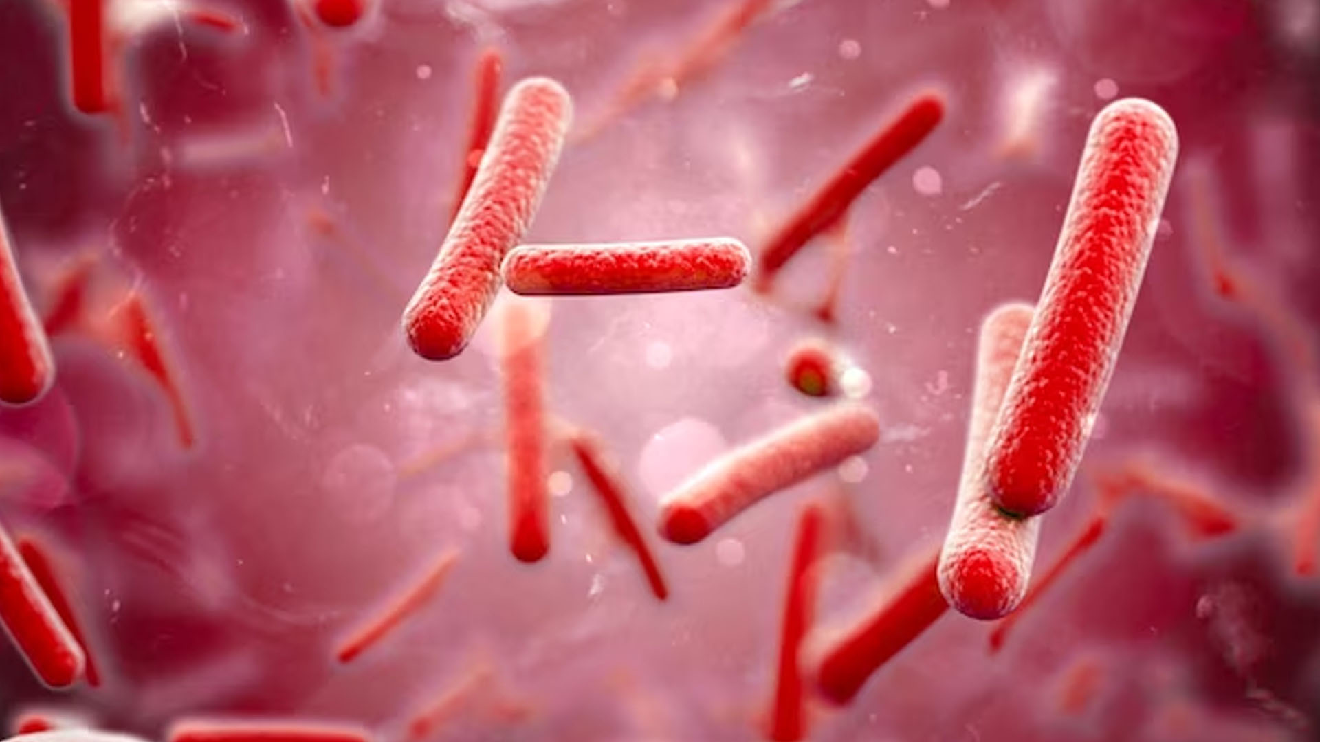 What are the Symptoms of Salmonella?