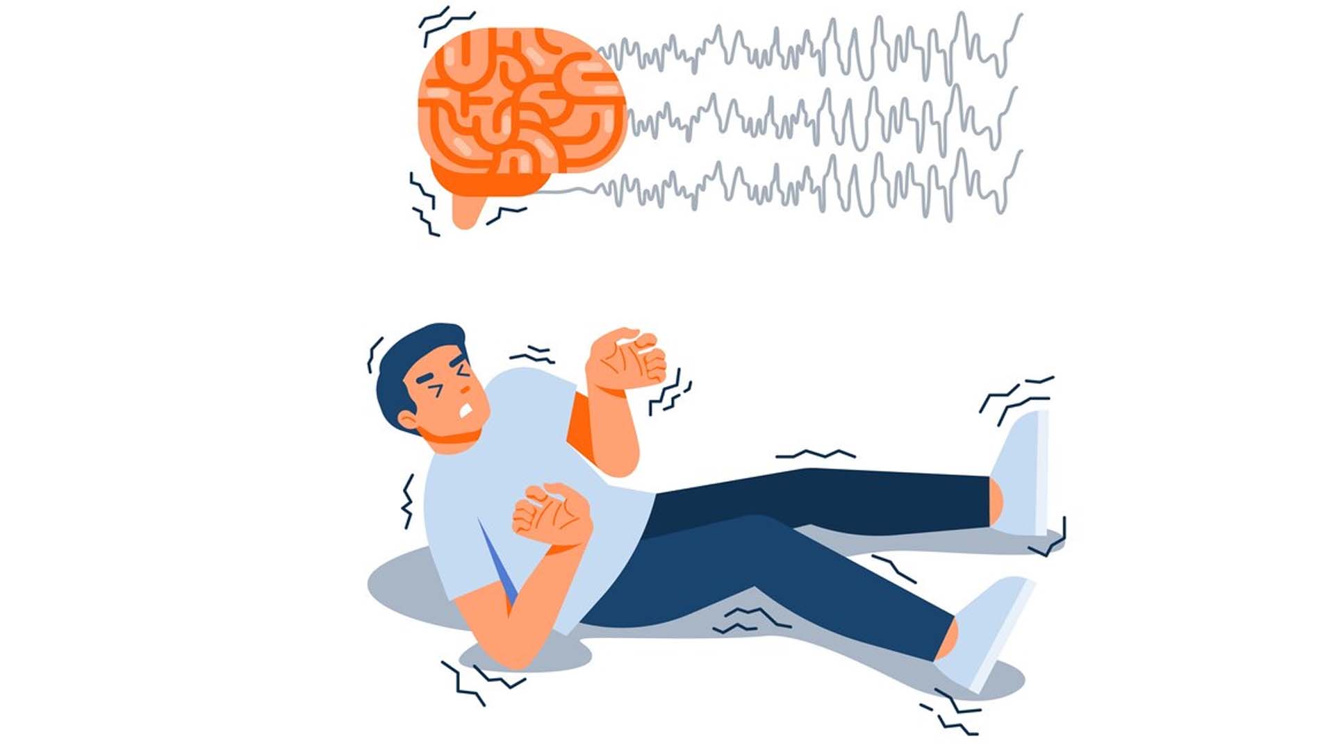 Epilepsy illustration