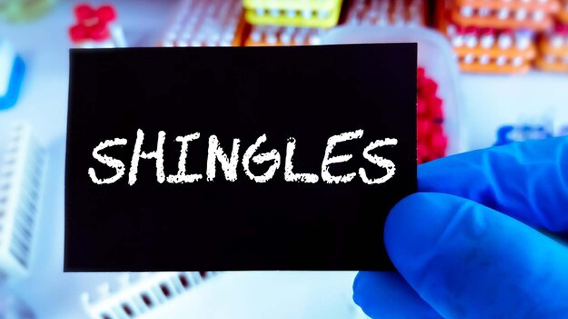 Shingles or Herpes zoster