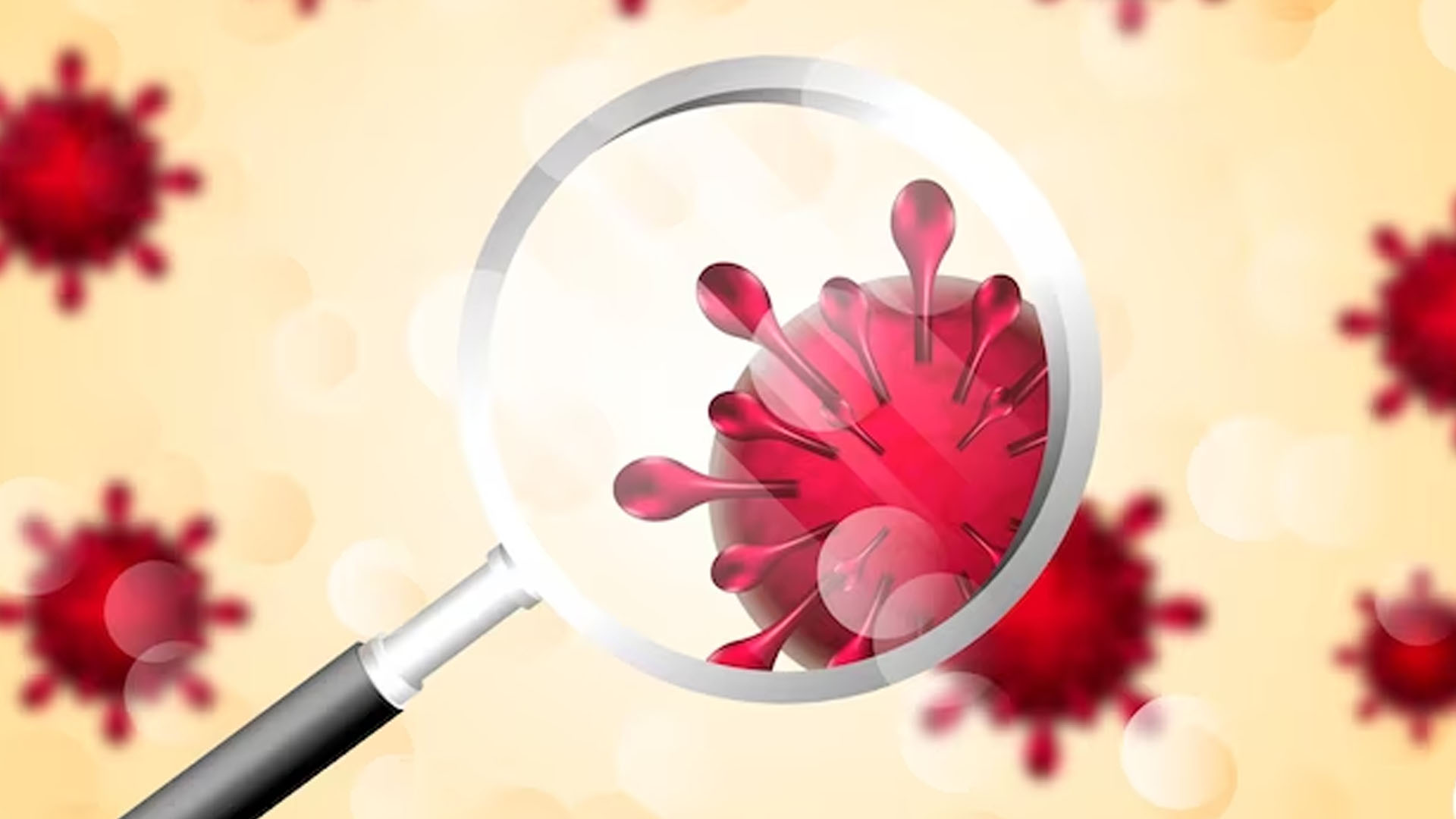 What are the Symptoms of Sickle Cell Disease?