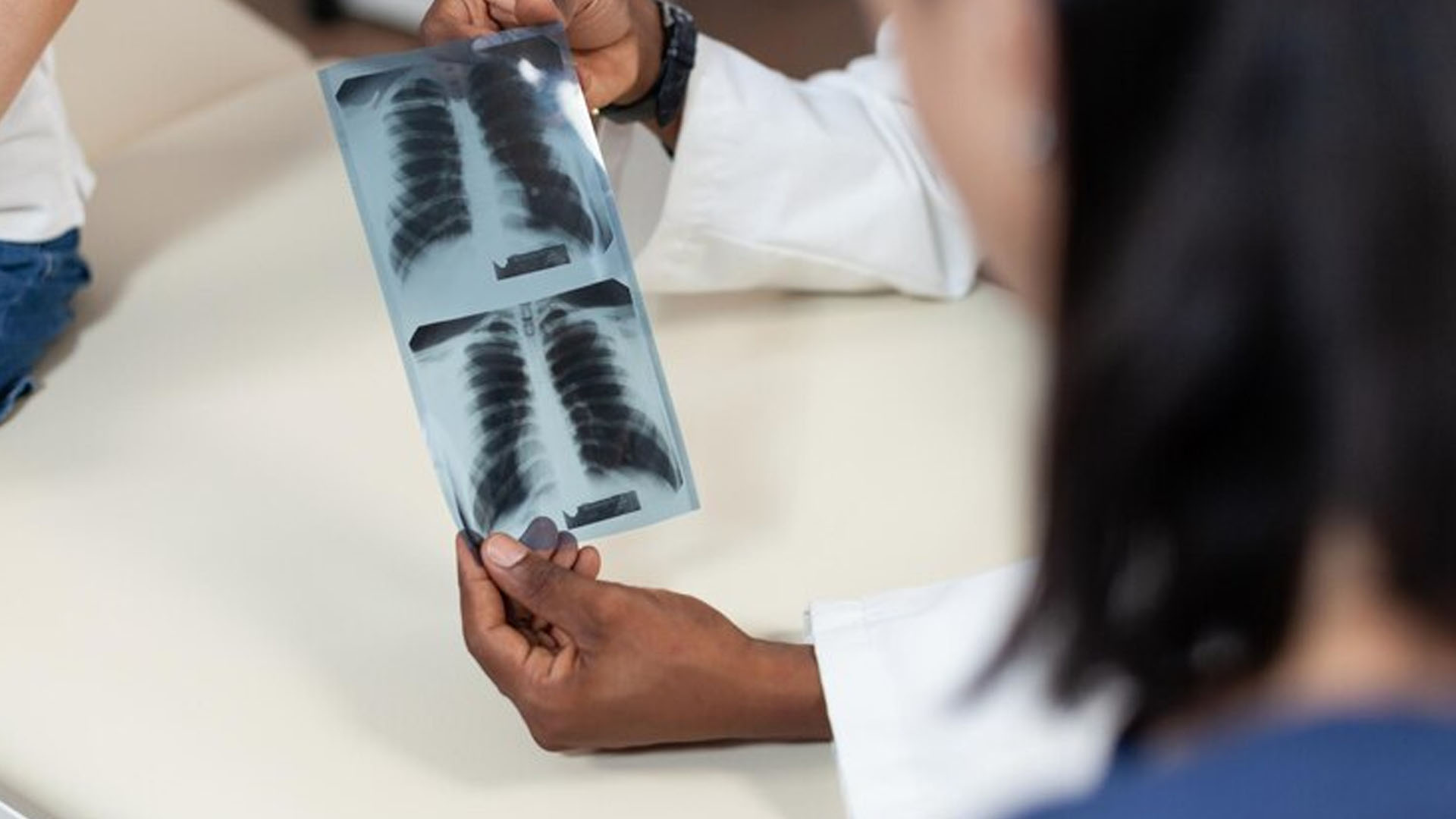 What are the Symptoms of Spinal Tuberculosis?