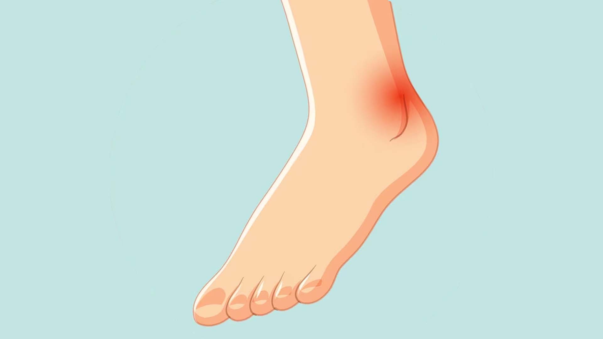 Swollen Ankle or Ankle edema