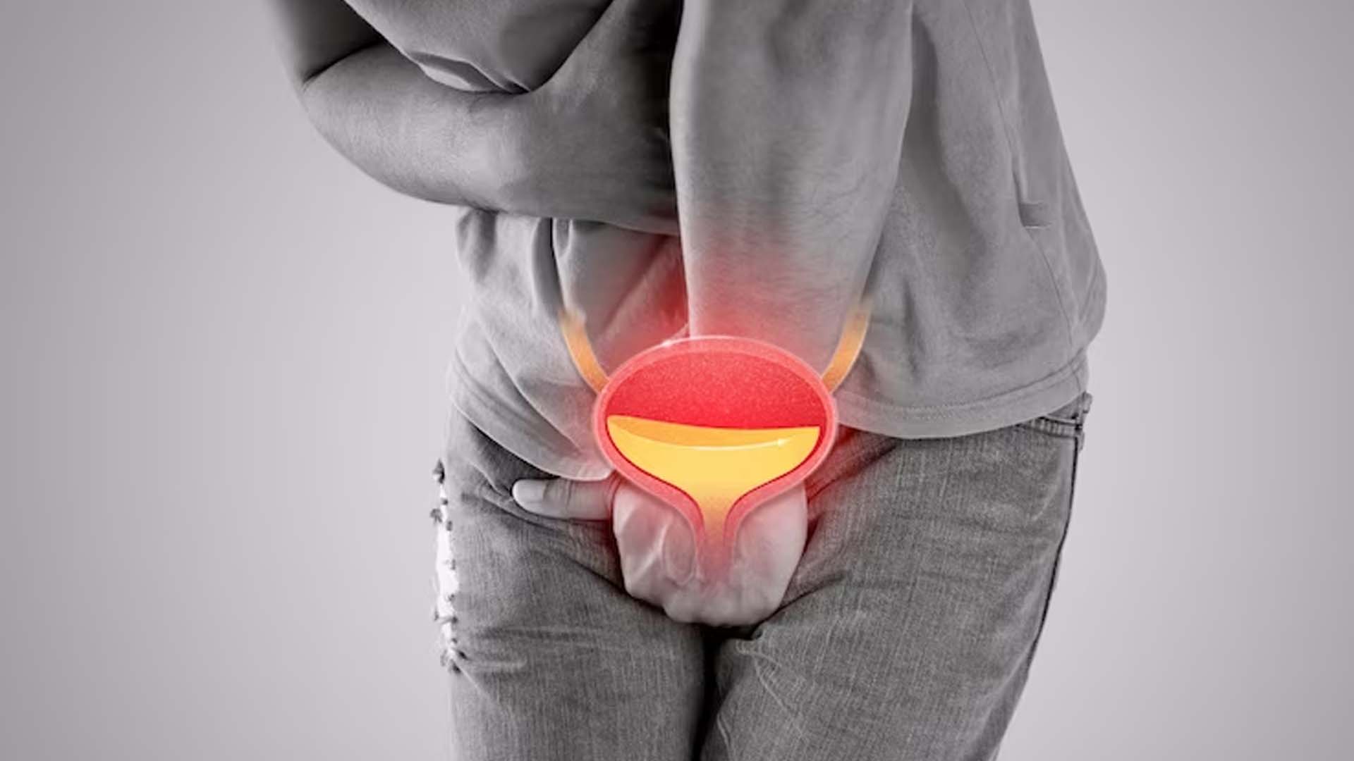 Urinary Retention in Man