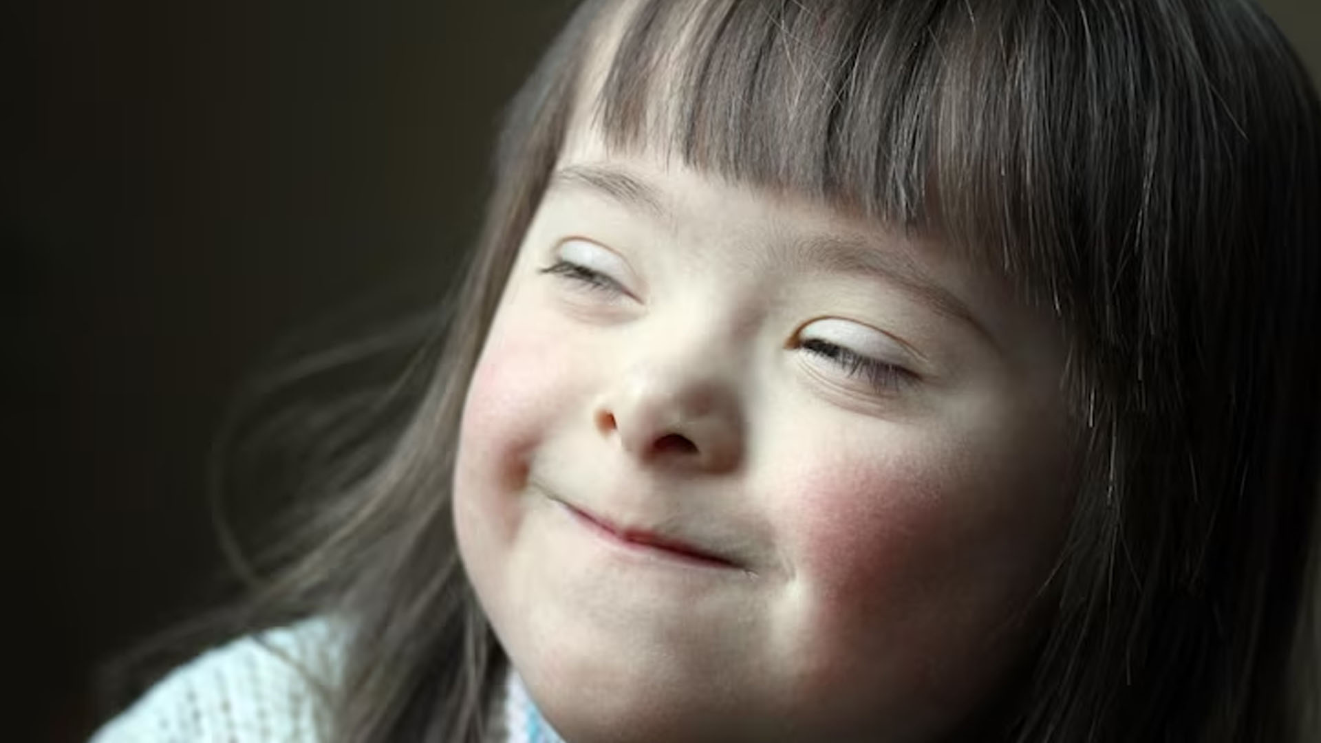 What are the Symptoms of Williams Syndrome?