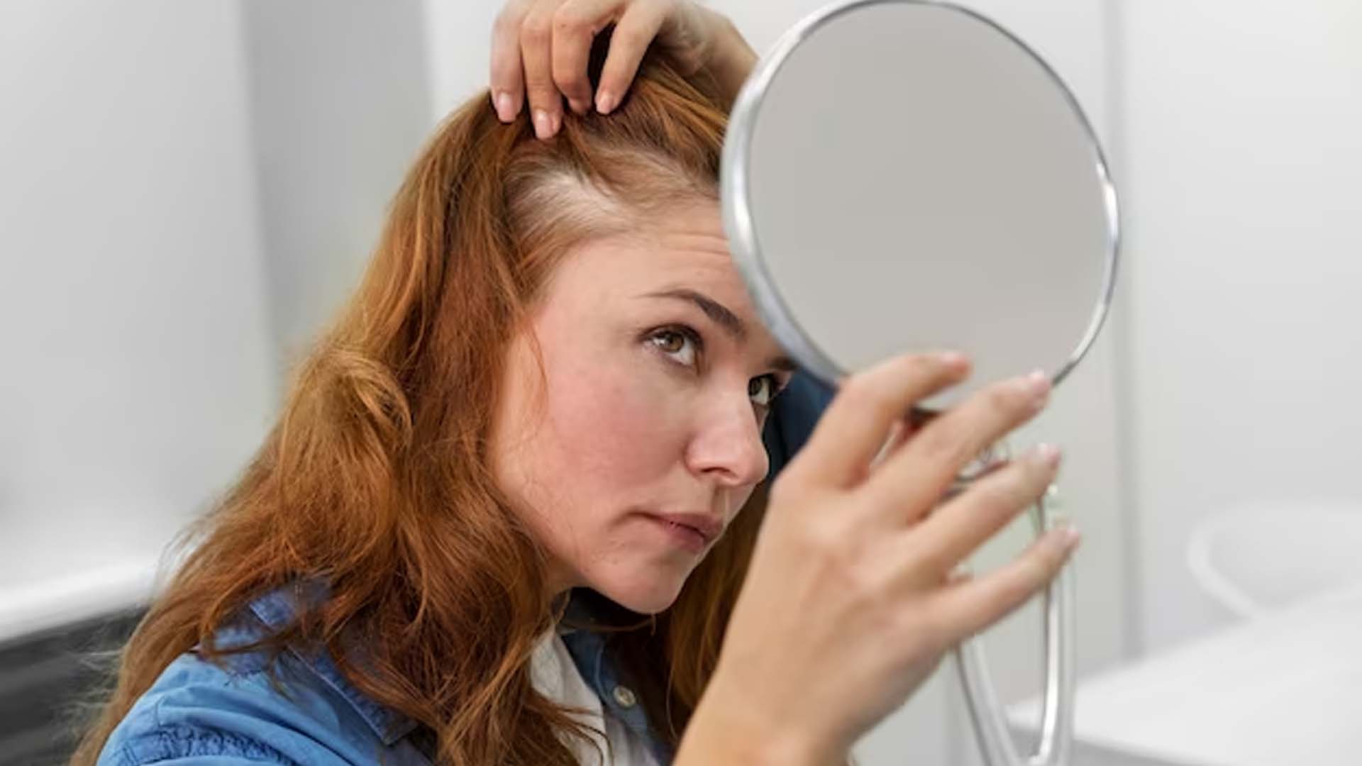Dry scalp