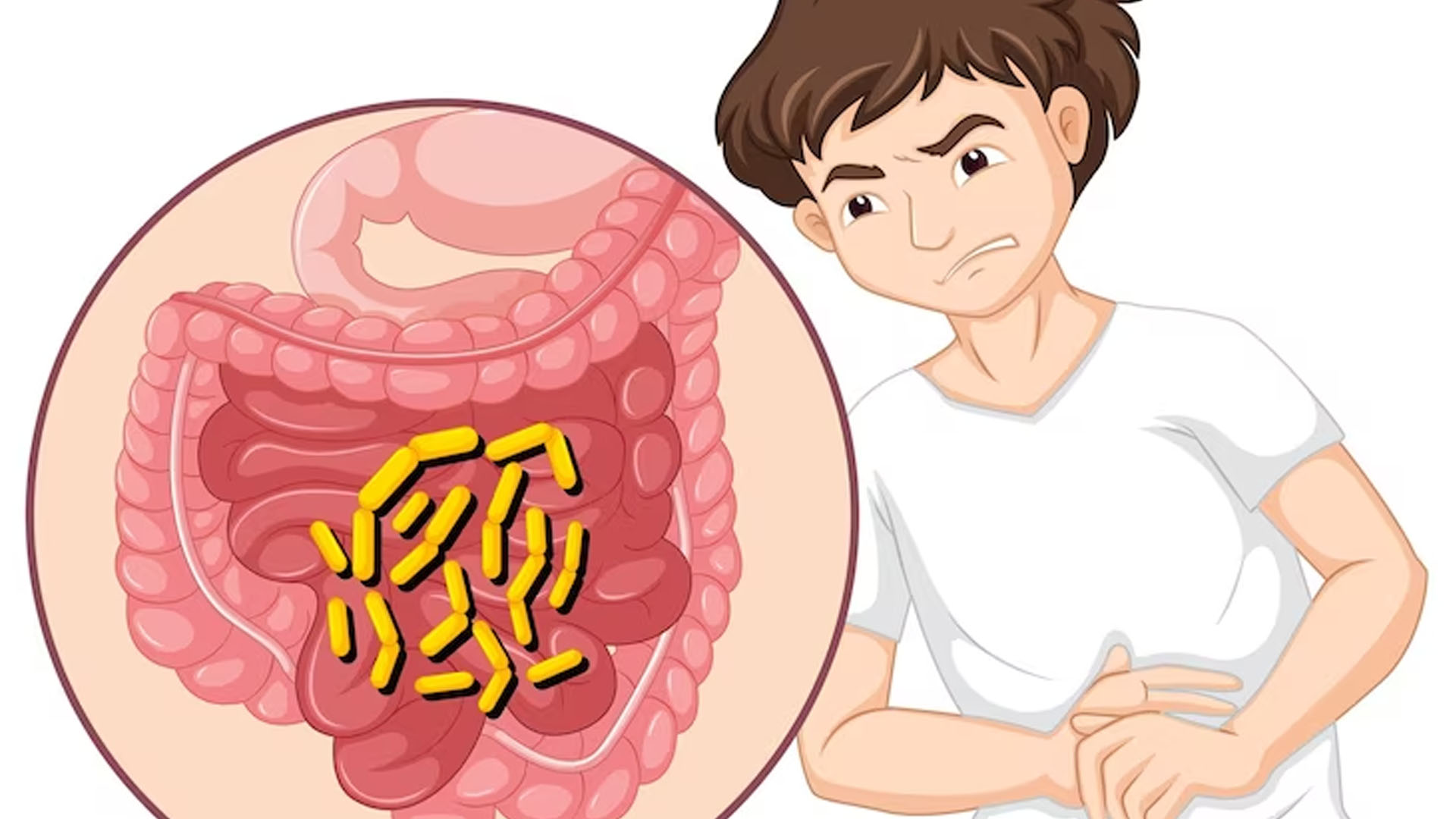 What are the Symptoms of Having Worms in Stomach?