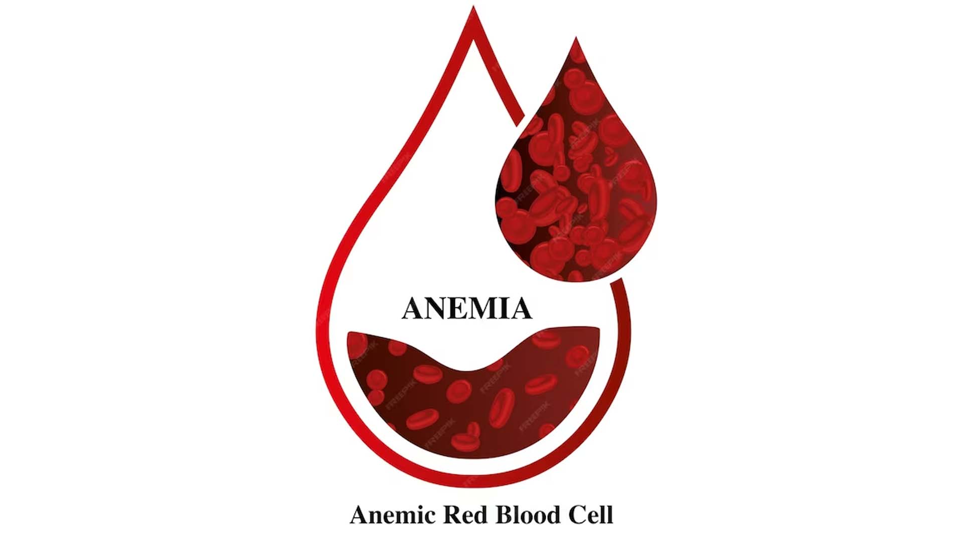 Anemia and Red Blood Cells