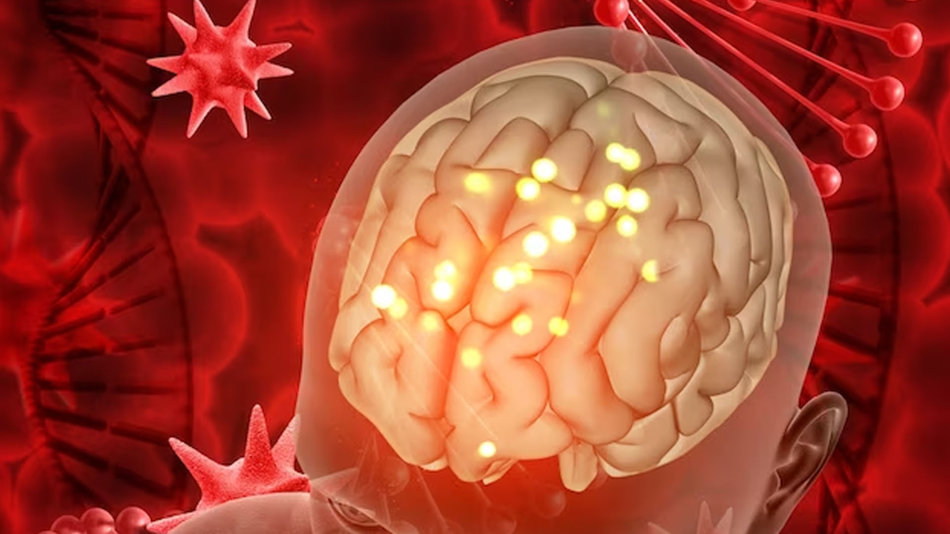 What are the Symptoms of Bacterial Meningitis?