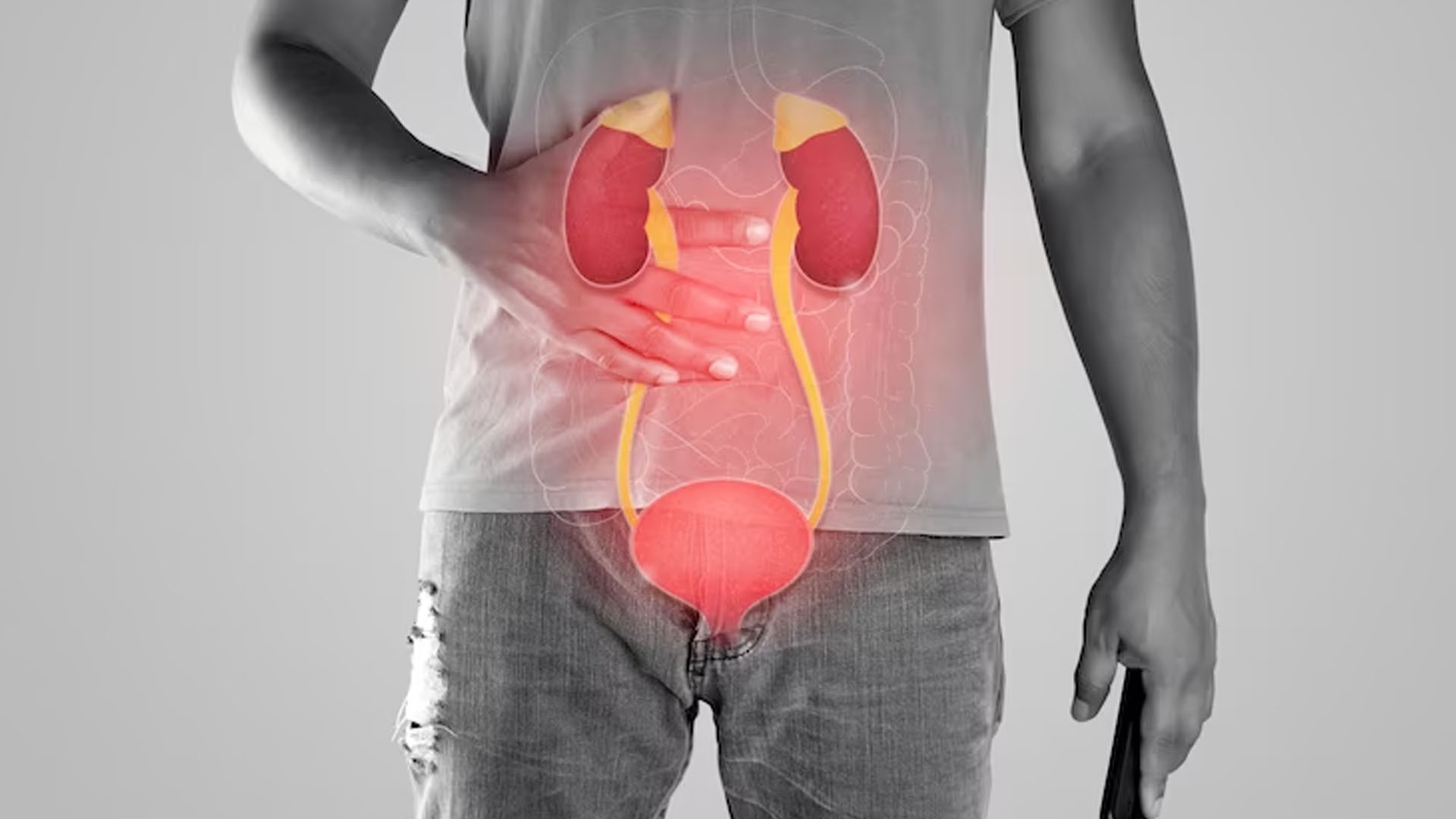What are the Symptoms of Bladder Cancer in Humans?