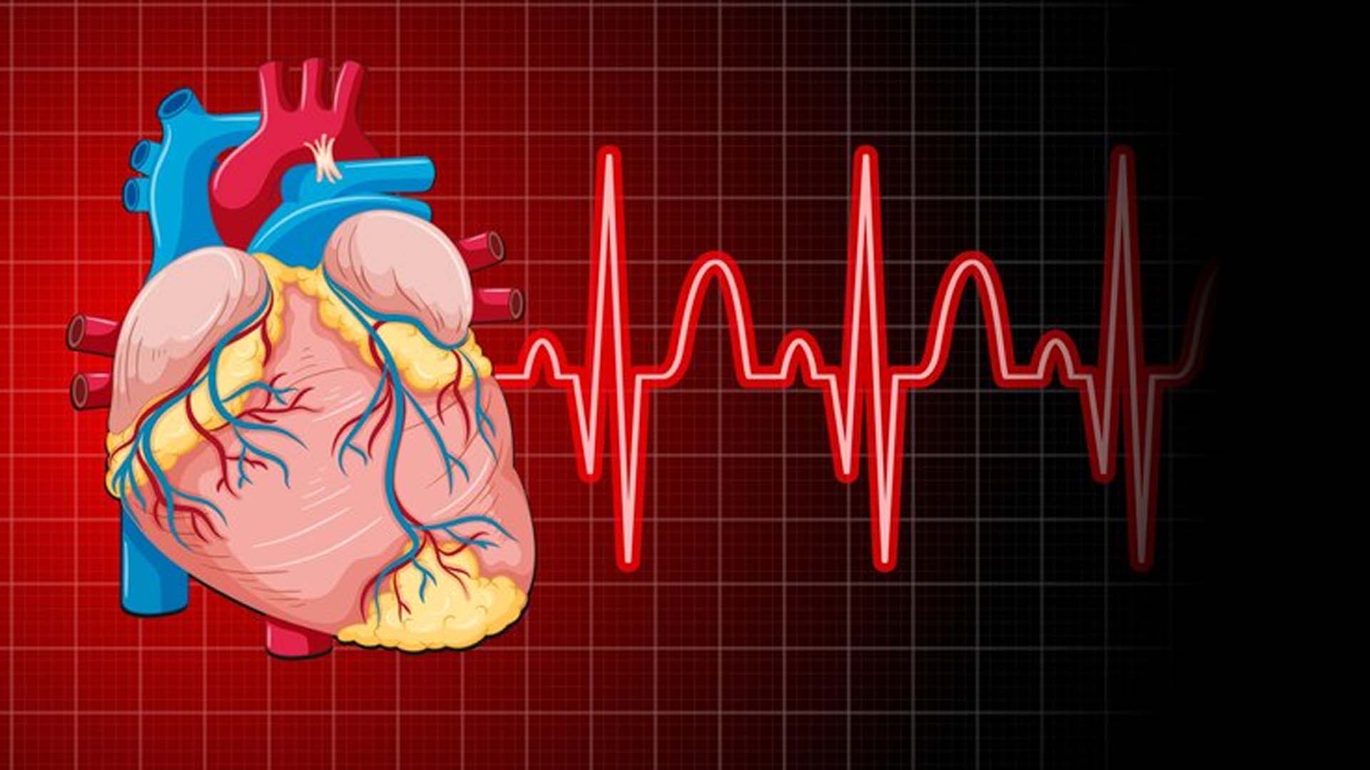 Heart with Cholesterol