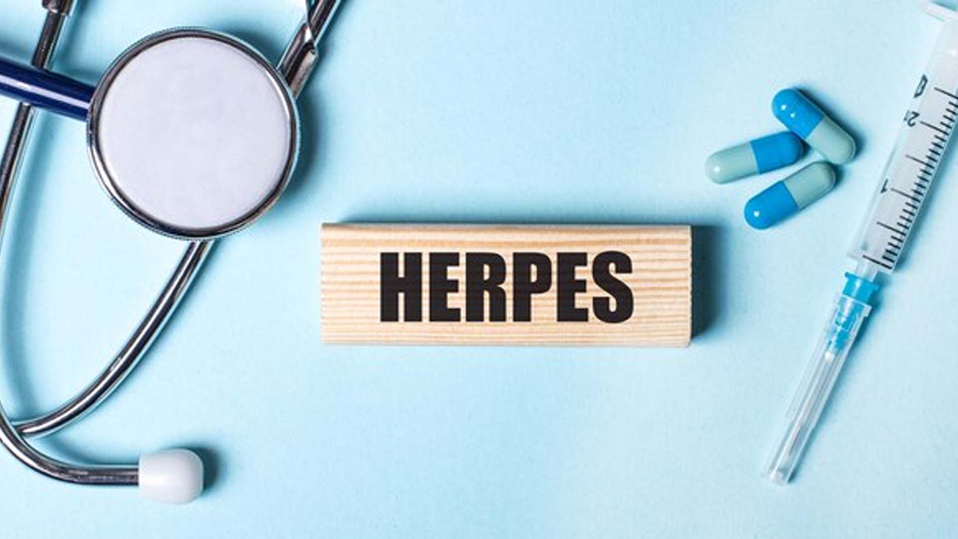 Herpes simplex viruses (HSV)
