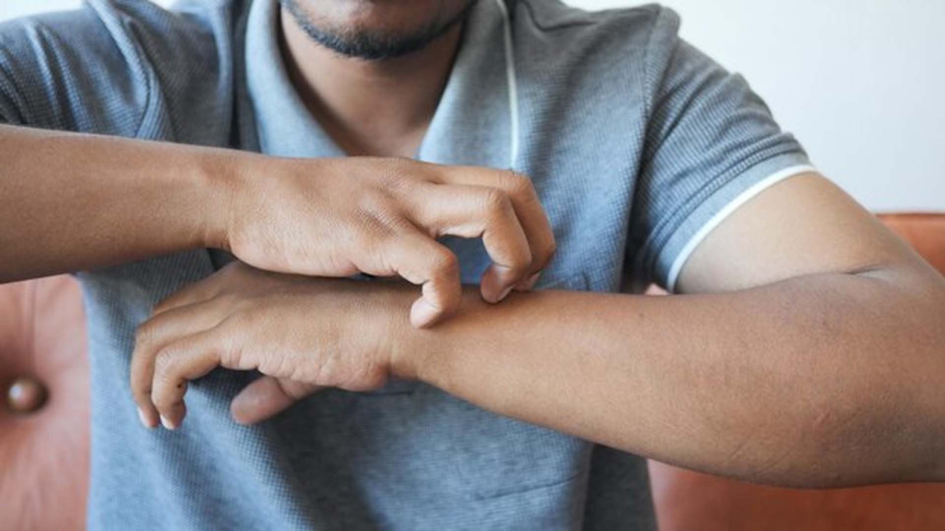 Man Scratching hand