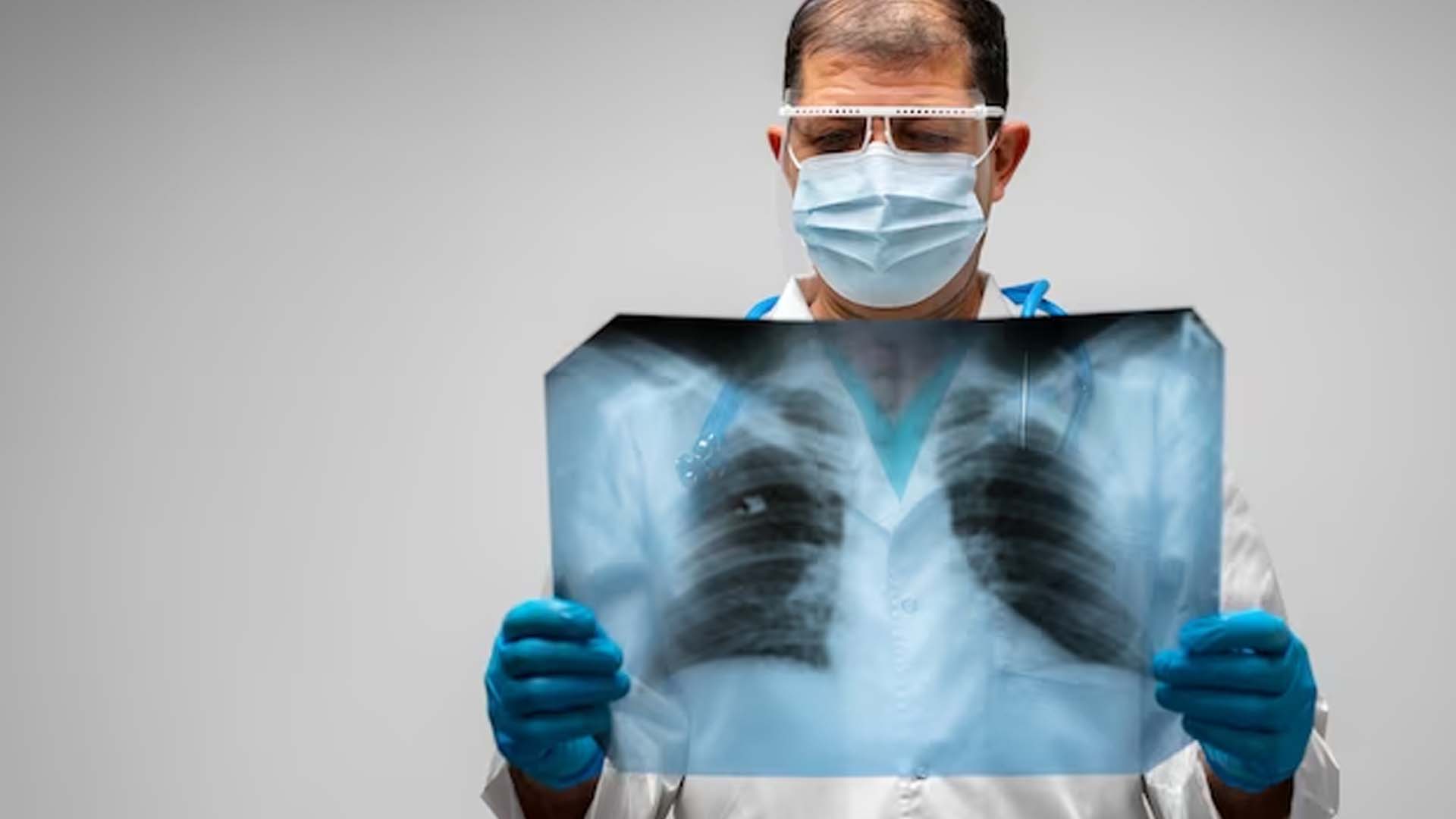 Doctor Holding X-ray of Lungs