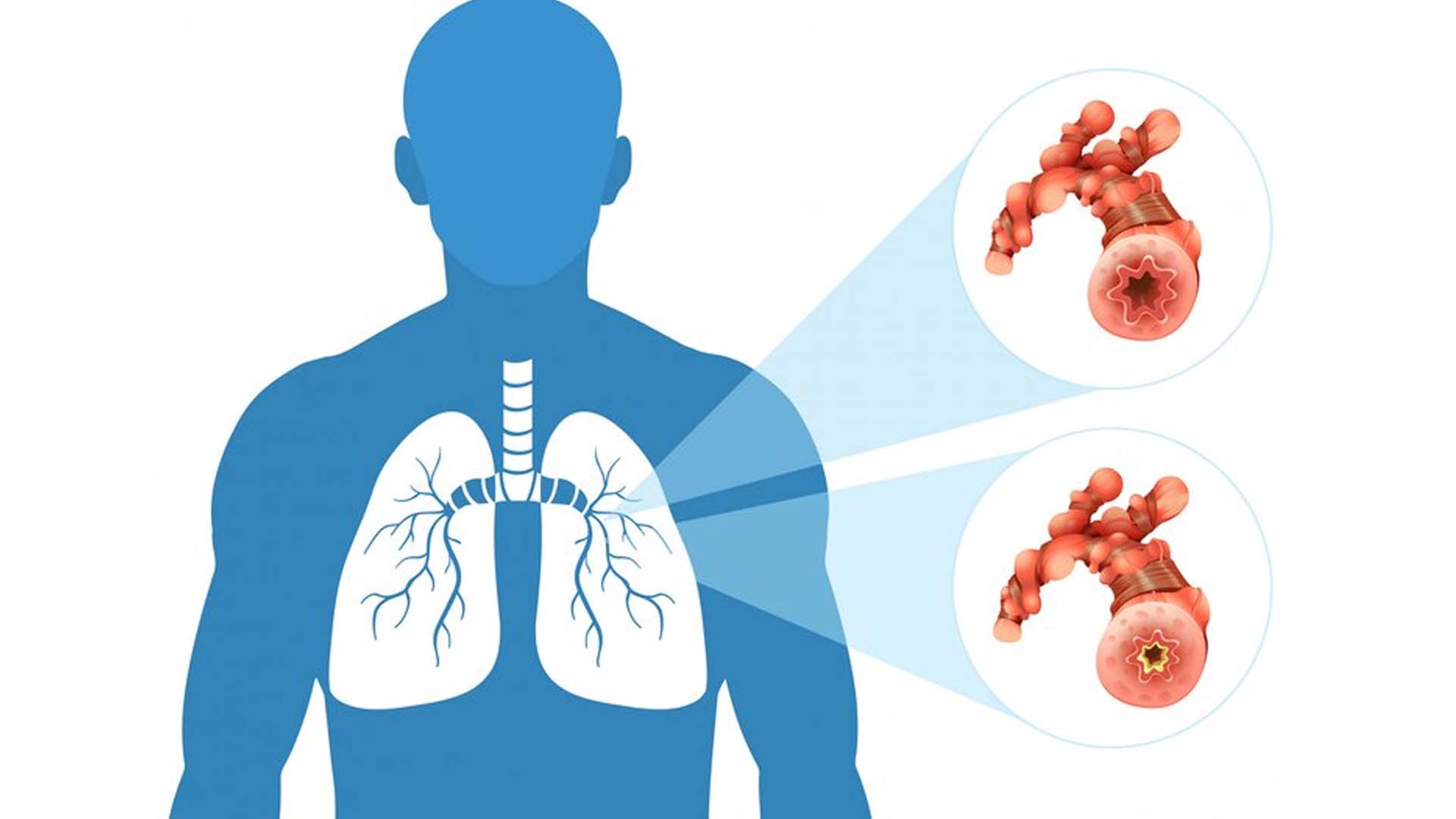Lung with open and Closed Tubes