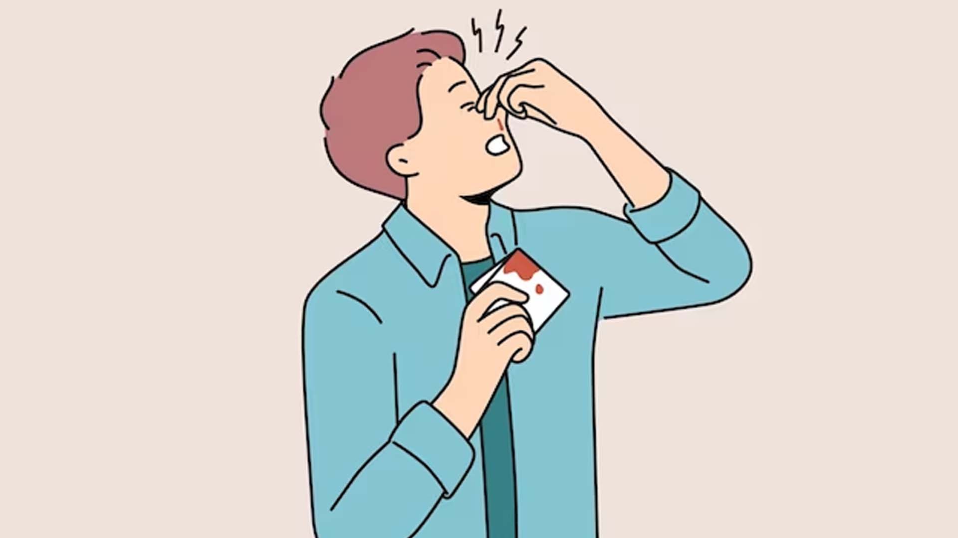 Man Holding Bleeding Nose