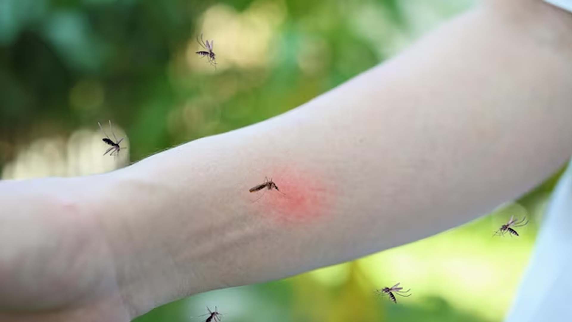 Mosquitoes Biting on Hand