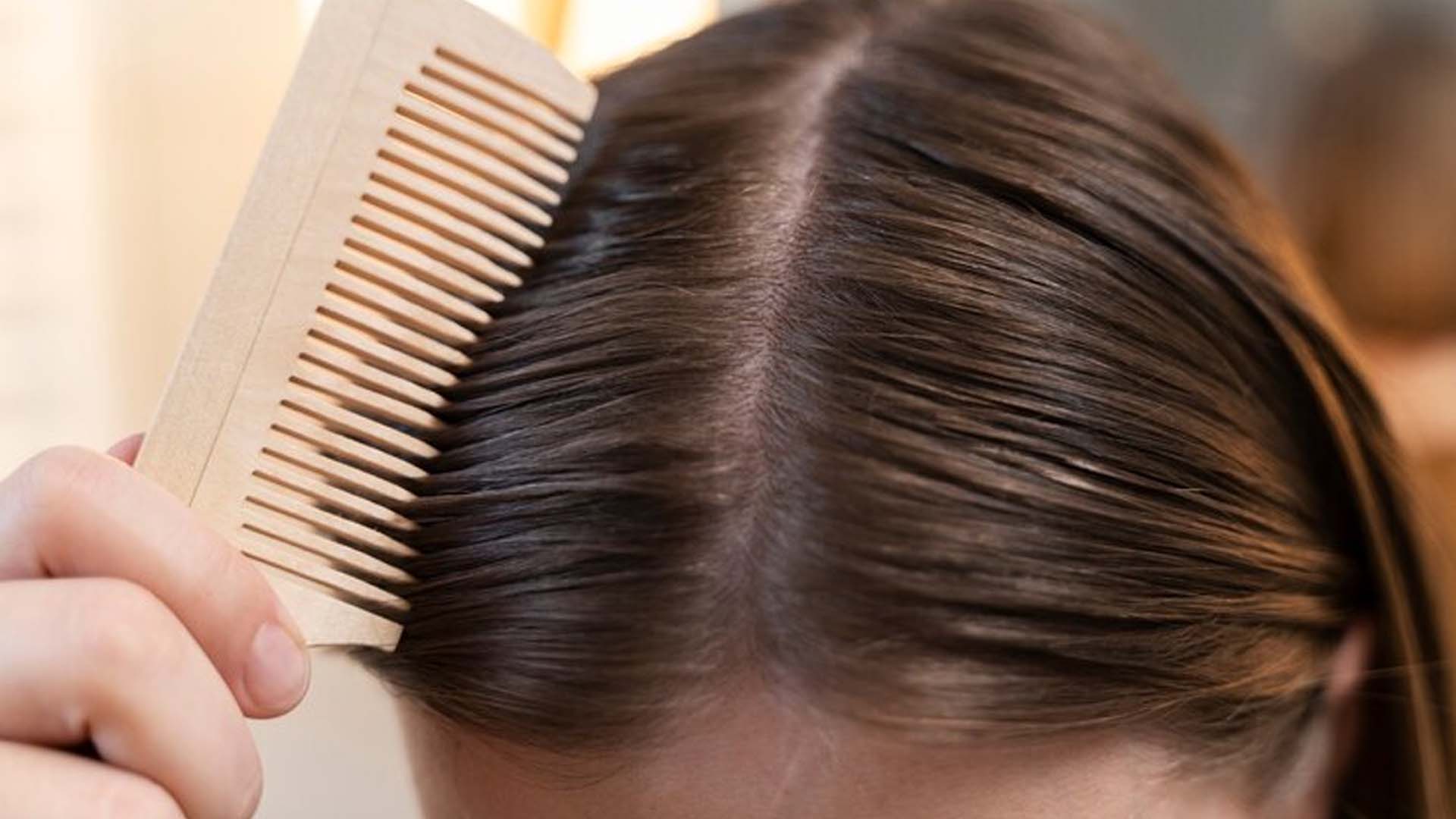 Women Showing her Scalp with Comb
