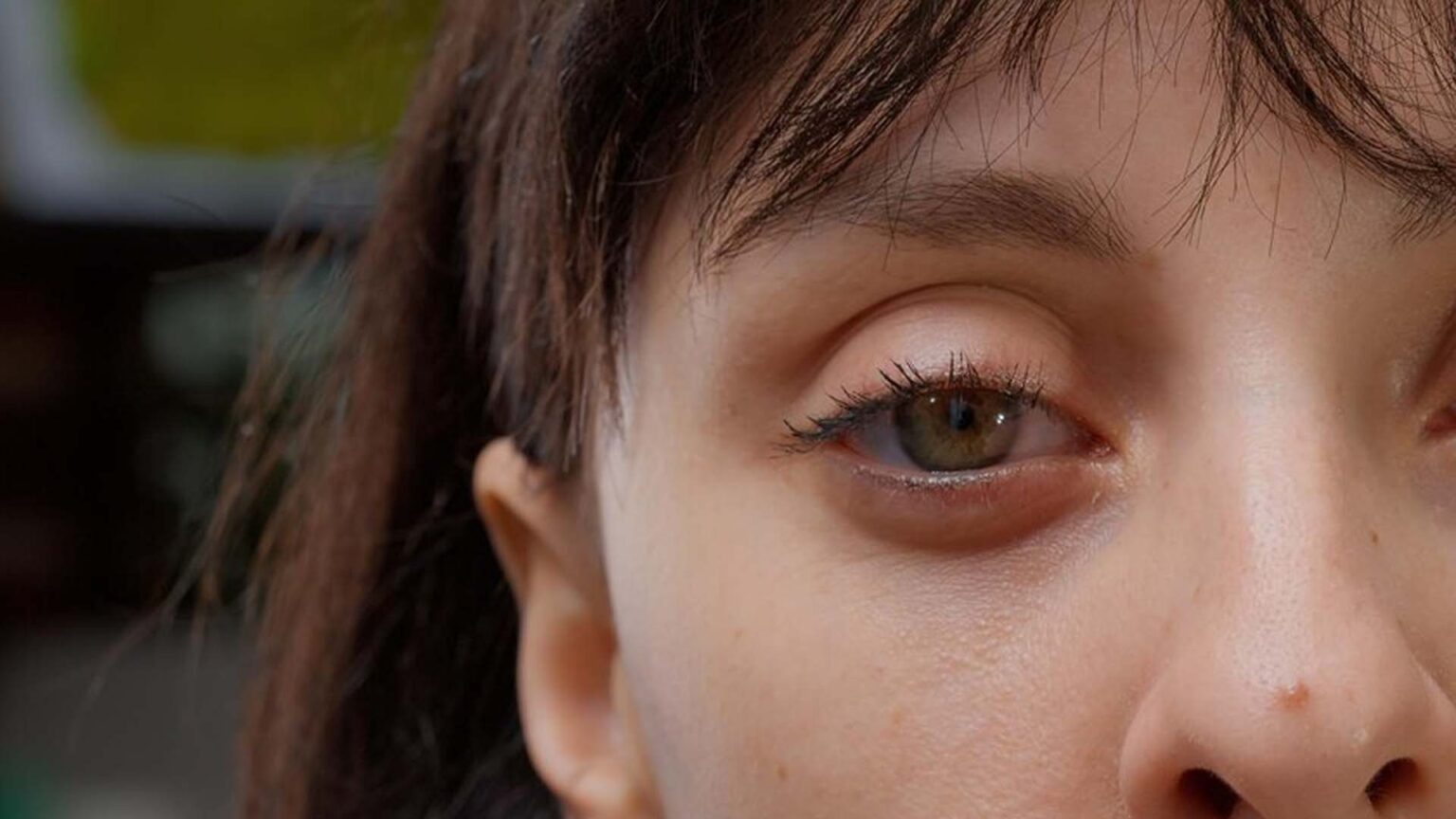 What Causes Swollen Eyelids? NutritionFact.in