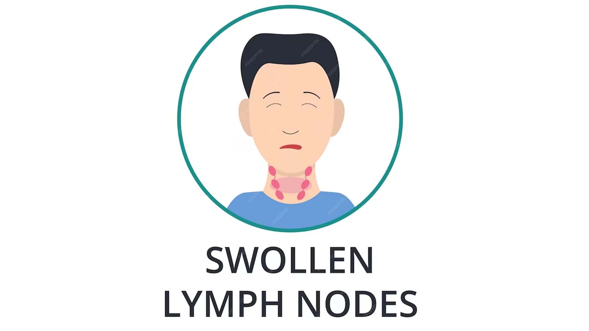 Swollen Lymph Nodes Cartoon