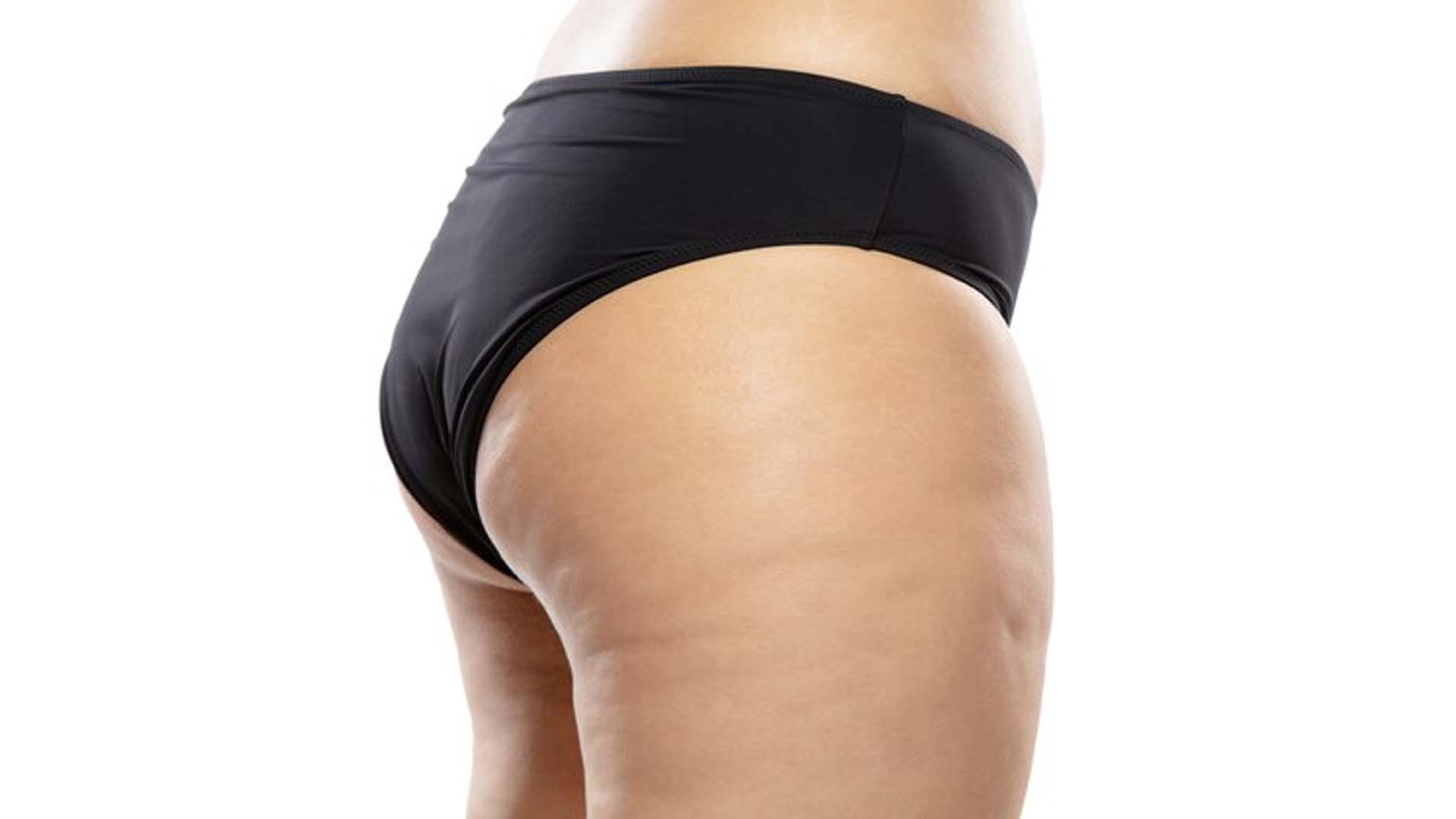 Women's Inner Thigh Fat