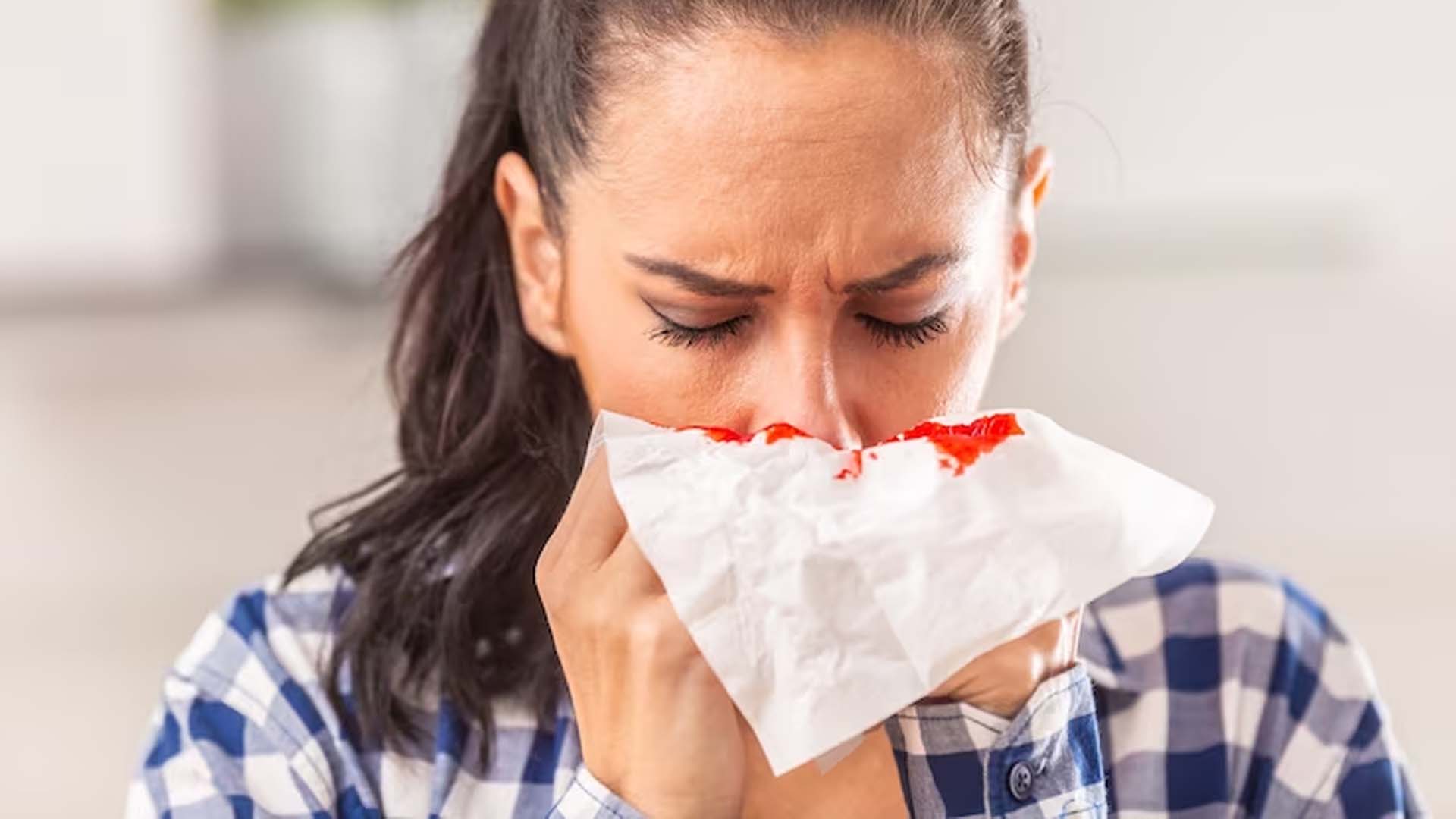 Women Holding Tissue with Blood from Nose