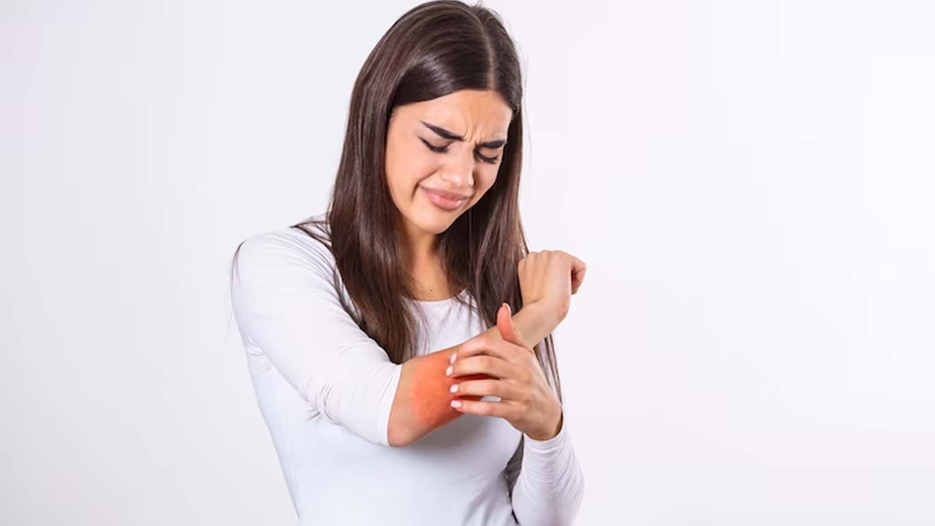 Rash on Women's hand