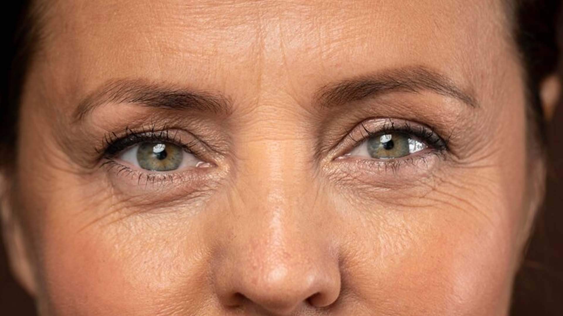 Wrinkles Around Women's Eye