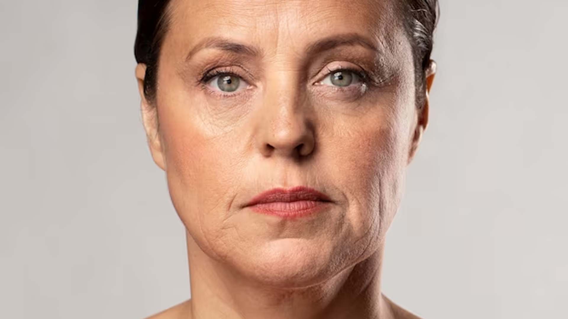 Women with Wrinkles and Sagging Skin