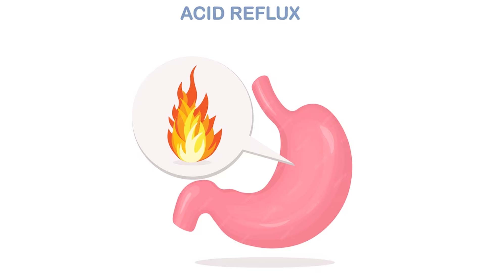 Acid Reflux illustration