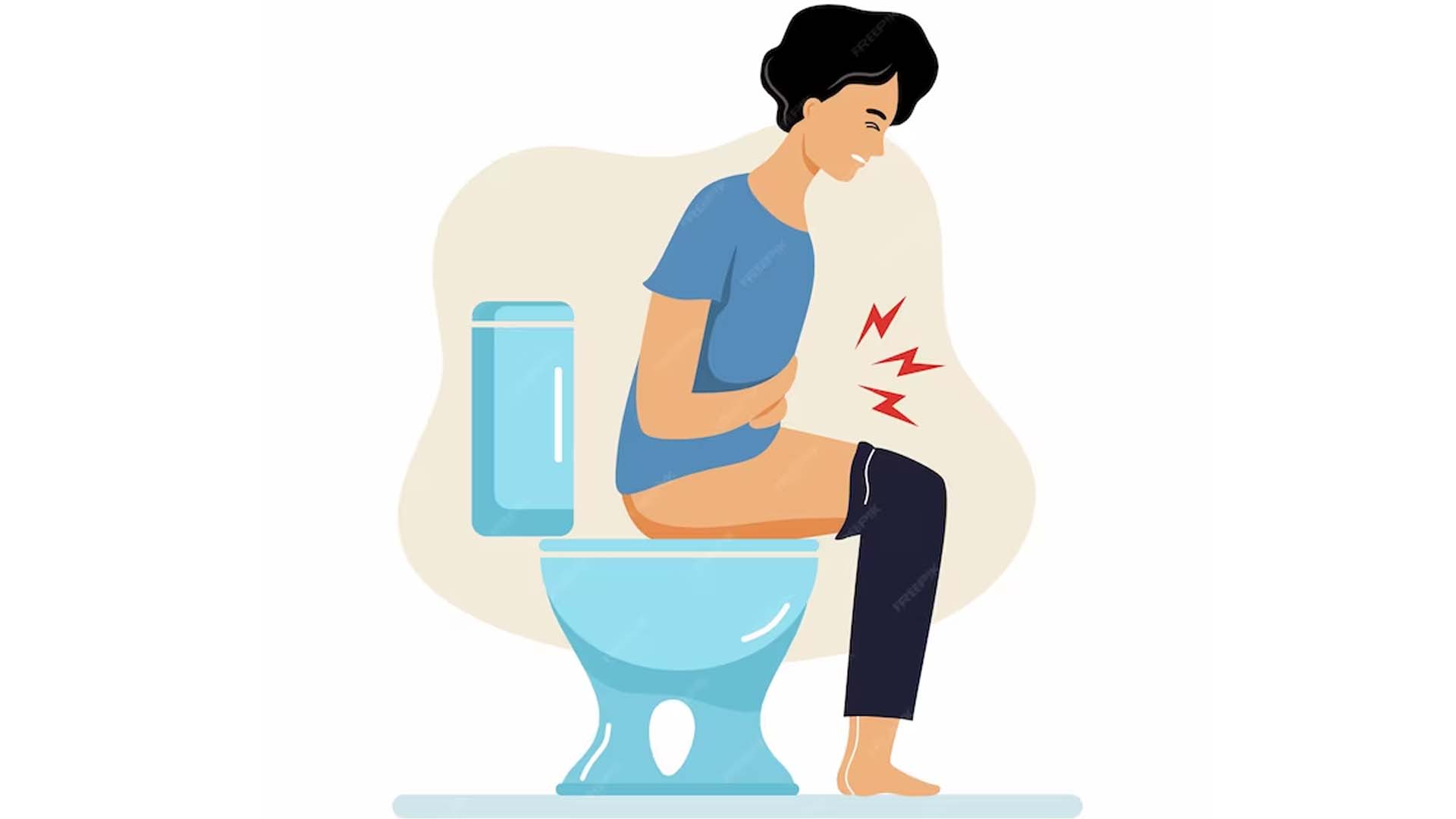 Constipation