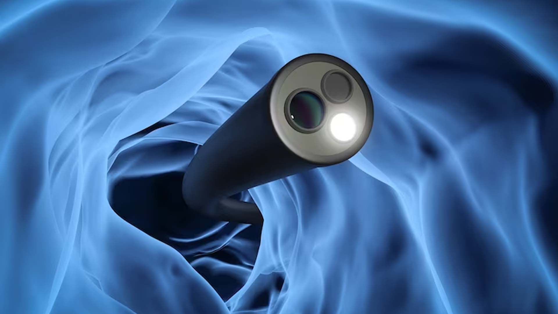 Endoscopy