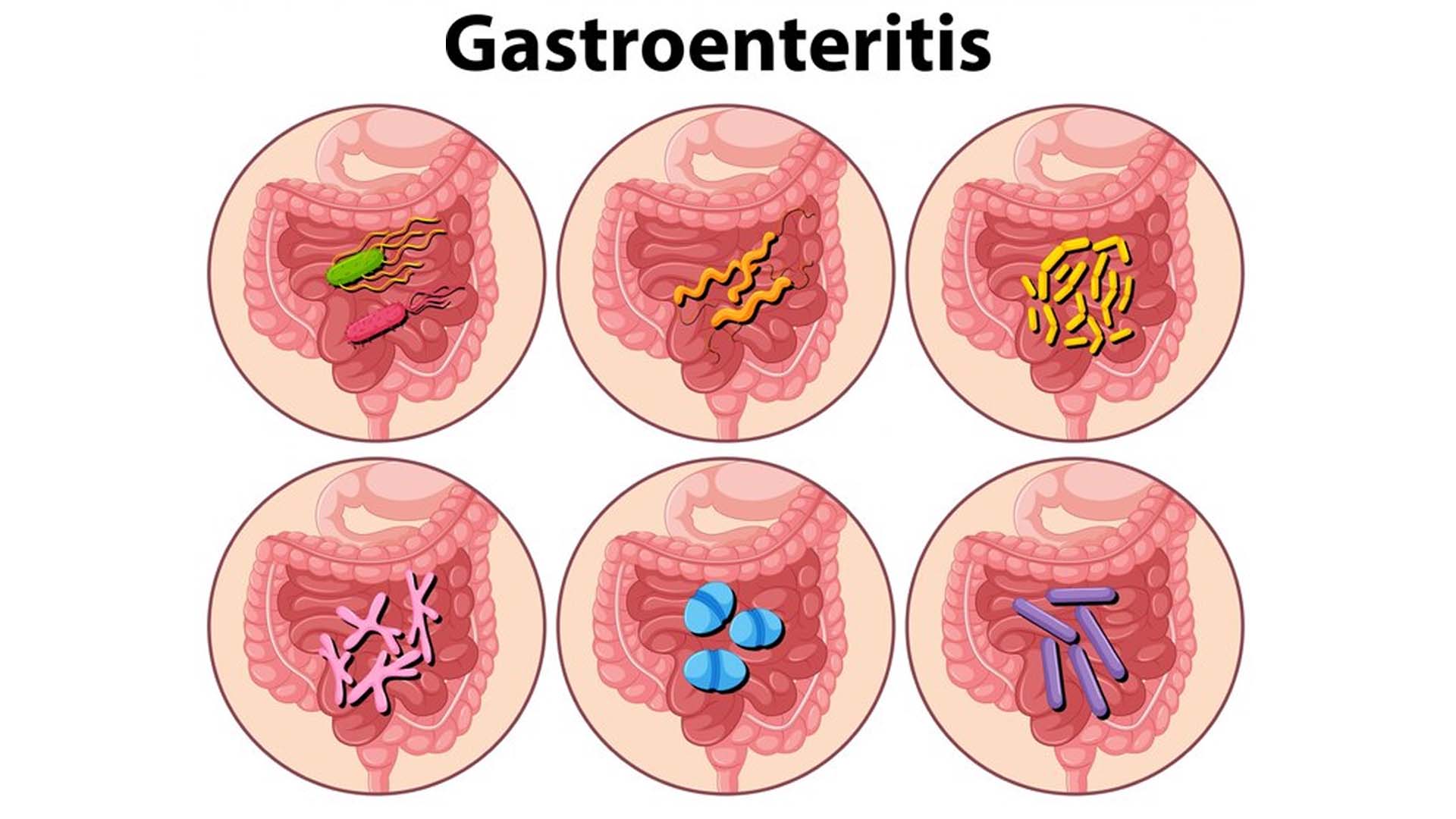 Gastroenteritis