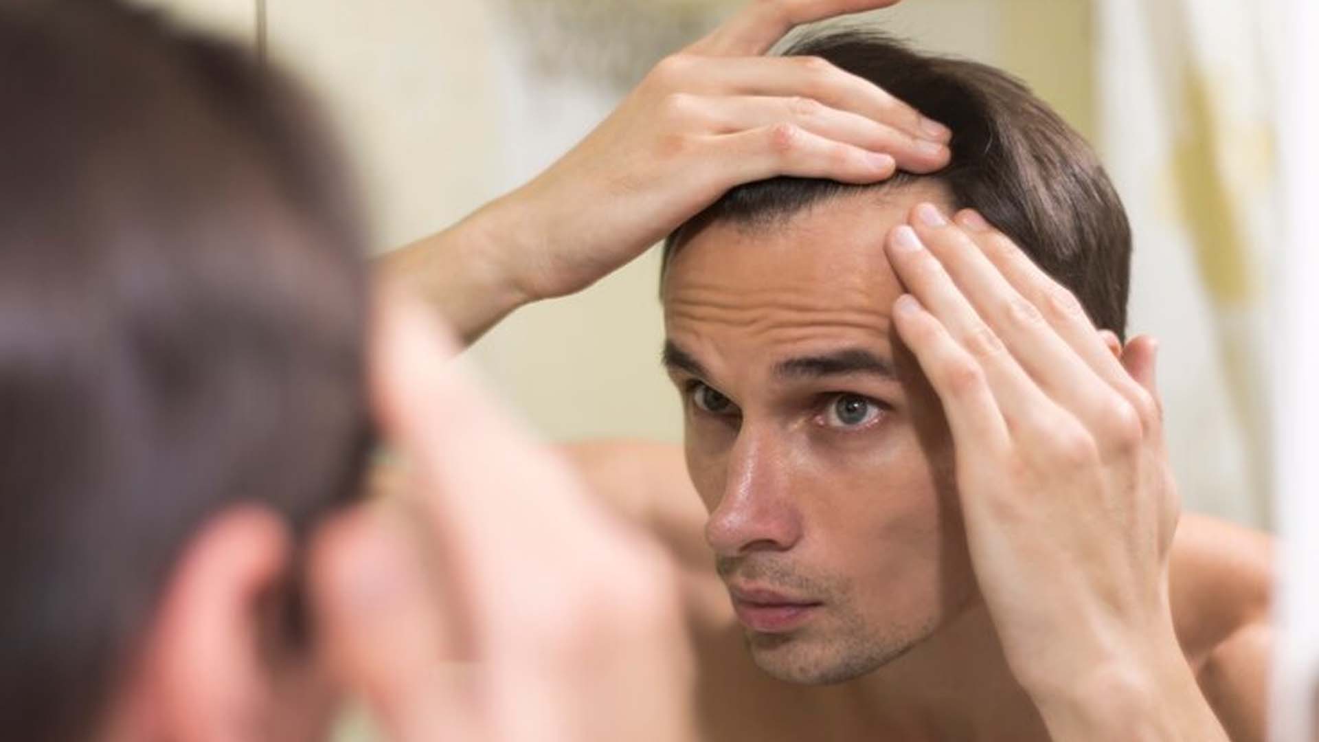 Hair Loss