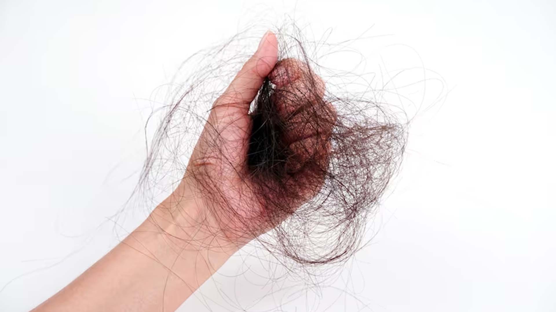 Hair loss