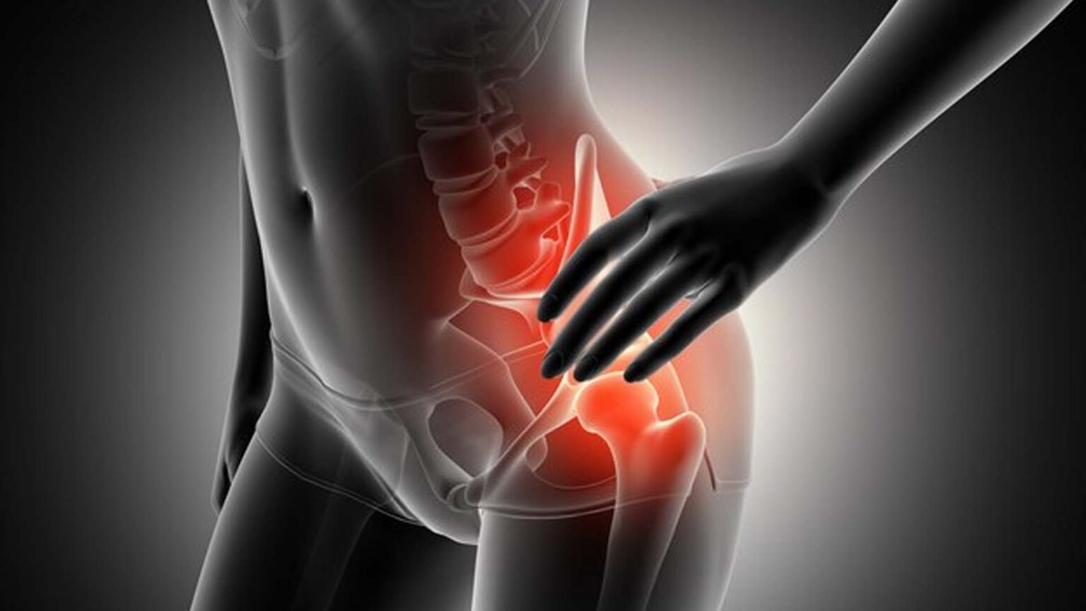 Can Hip Bursitis Cause Pain Down the Leg? NutritionFact.in