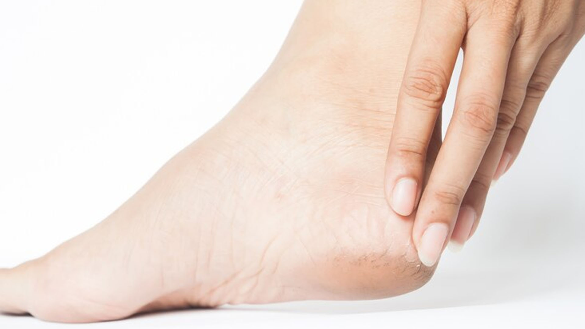 What are the Home Remedies for Cracked Heel?