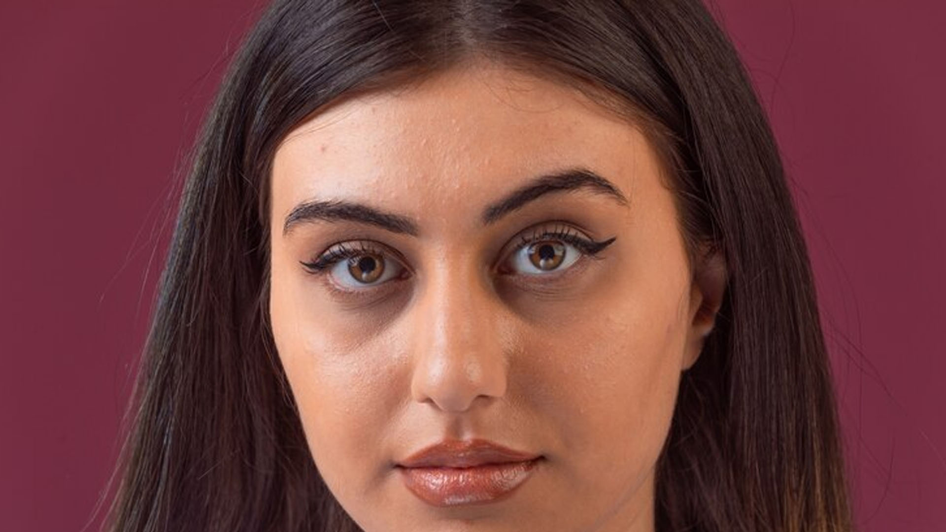 What are the Home Remedies for Dark Circles?