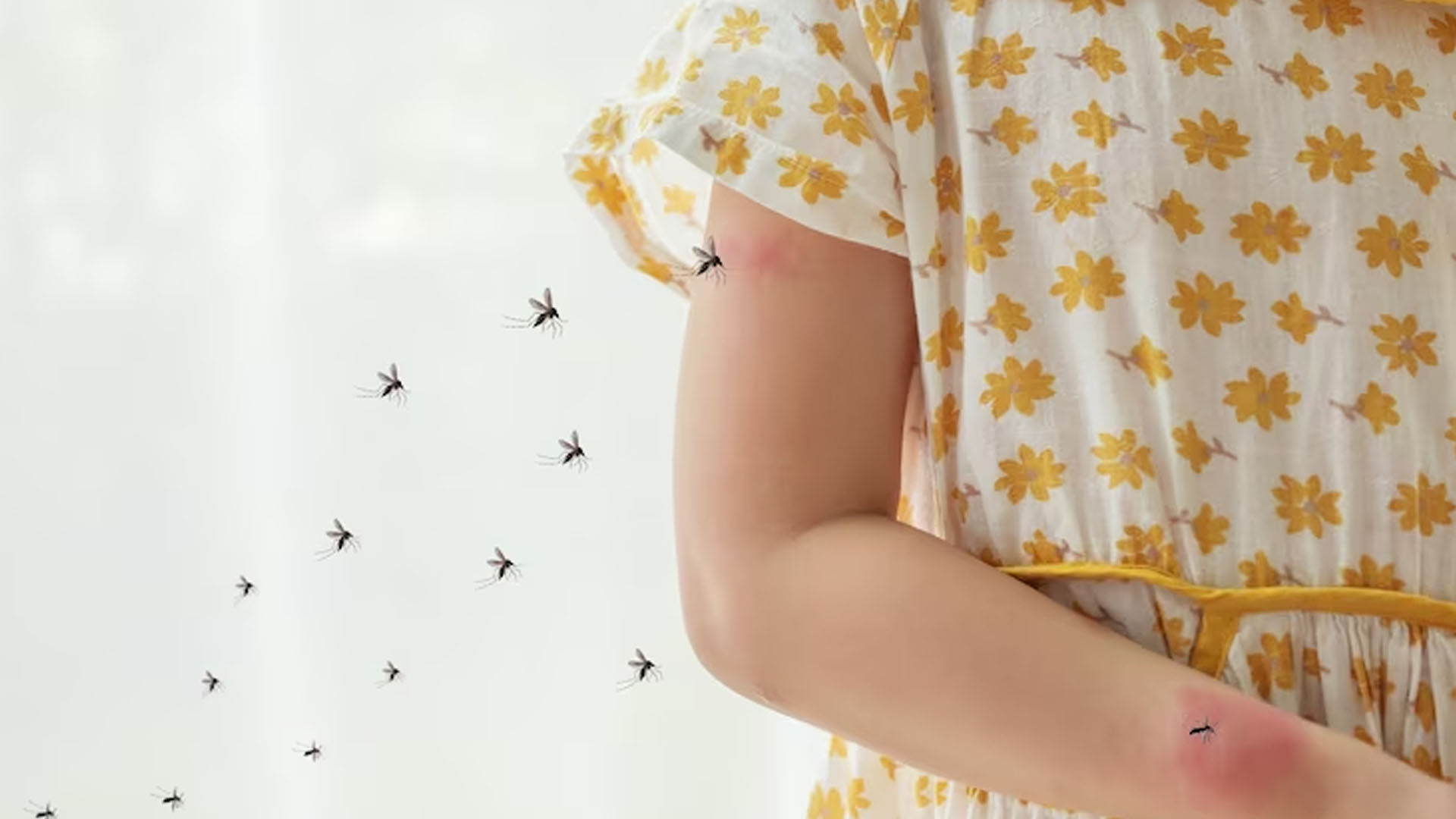 What are the Home Remedies to treat Dengue?