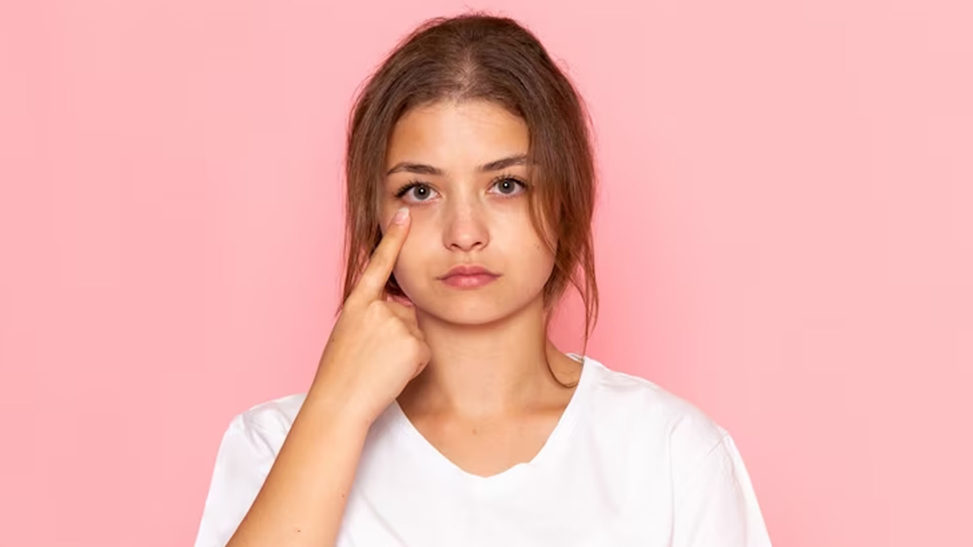What are the Home Remedies for Dry Eyes?