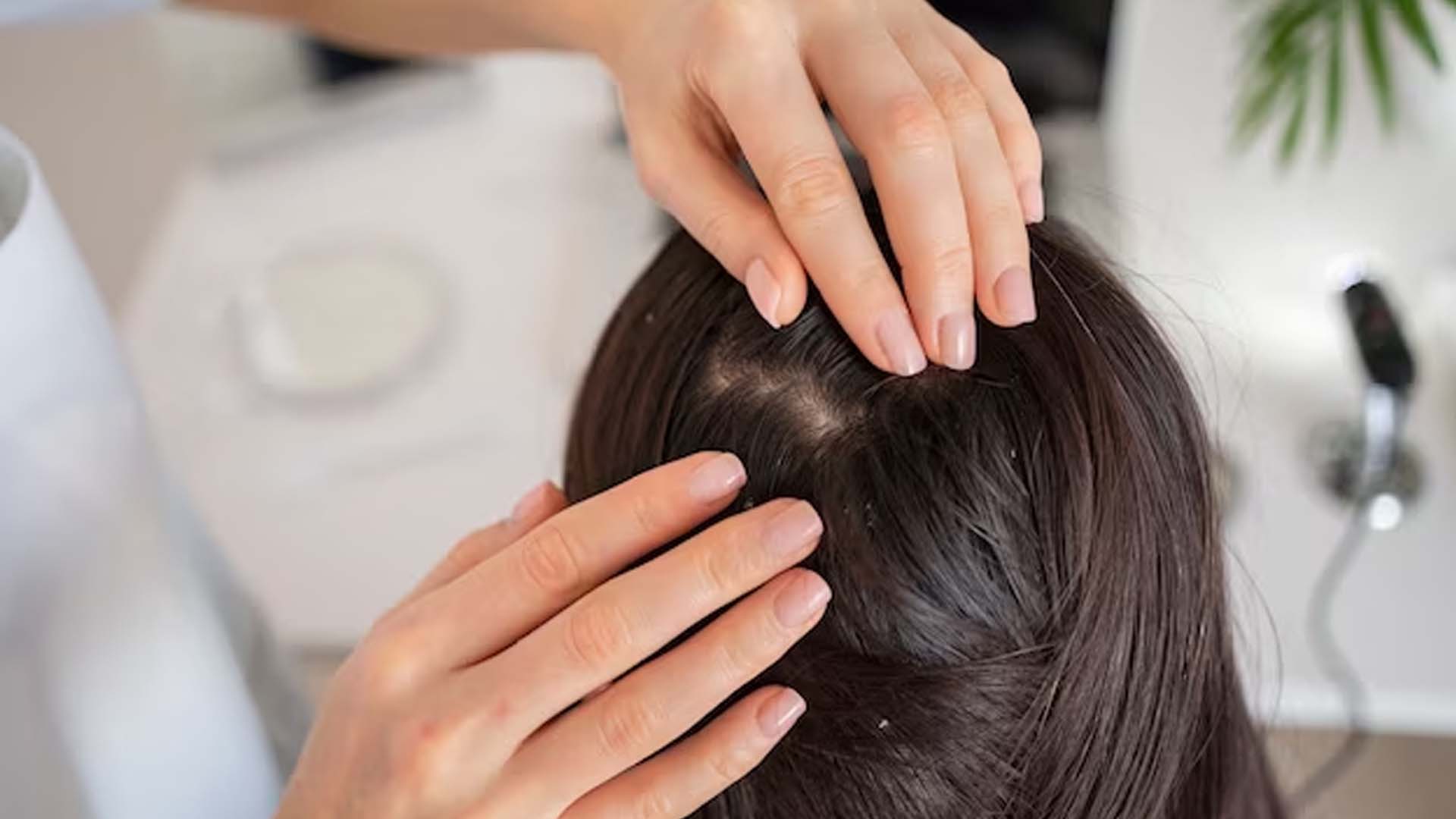 Dry Scalp