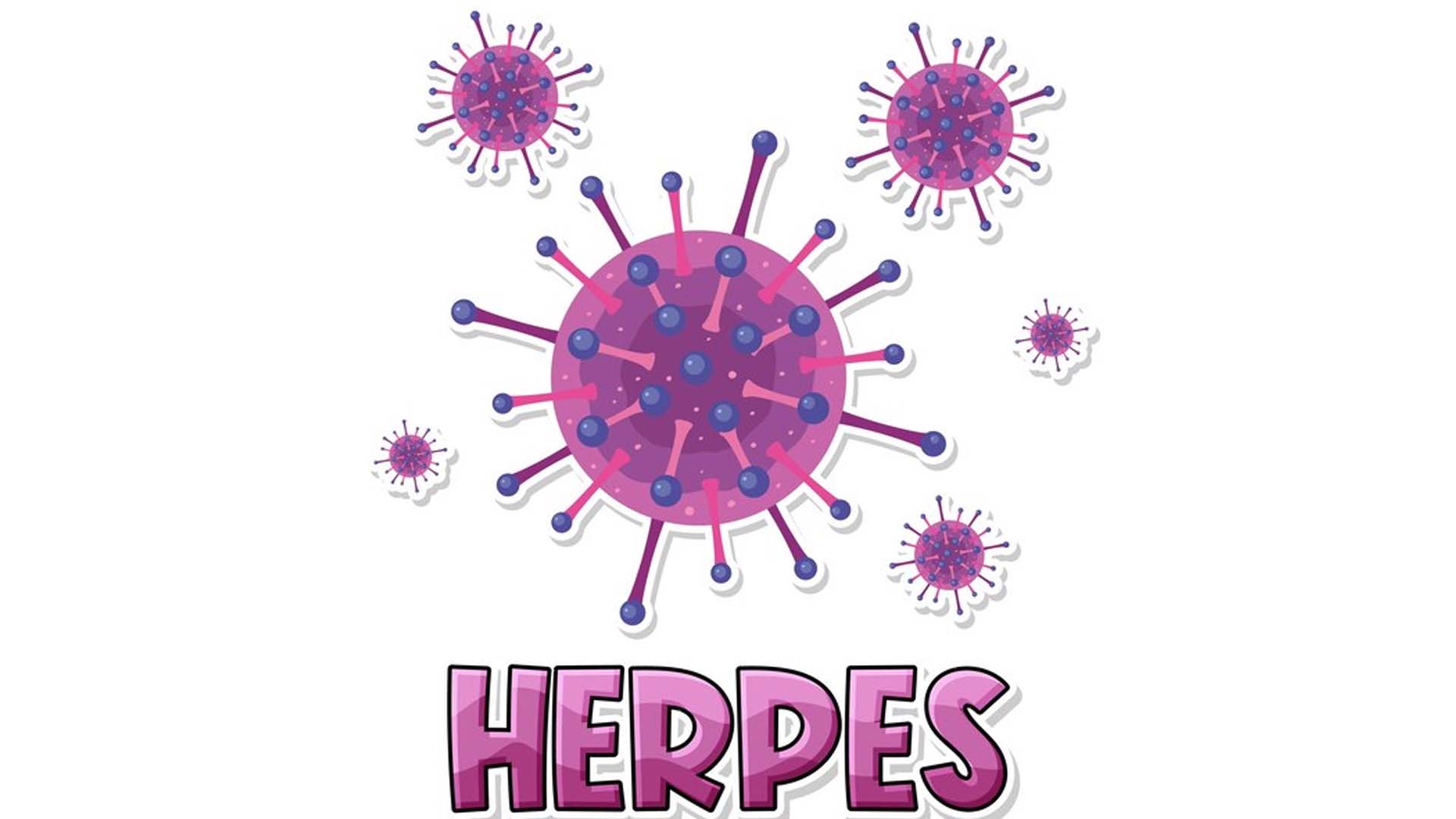 Herpes Virus